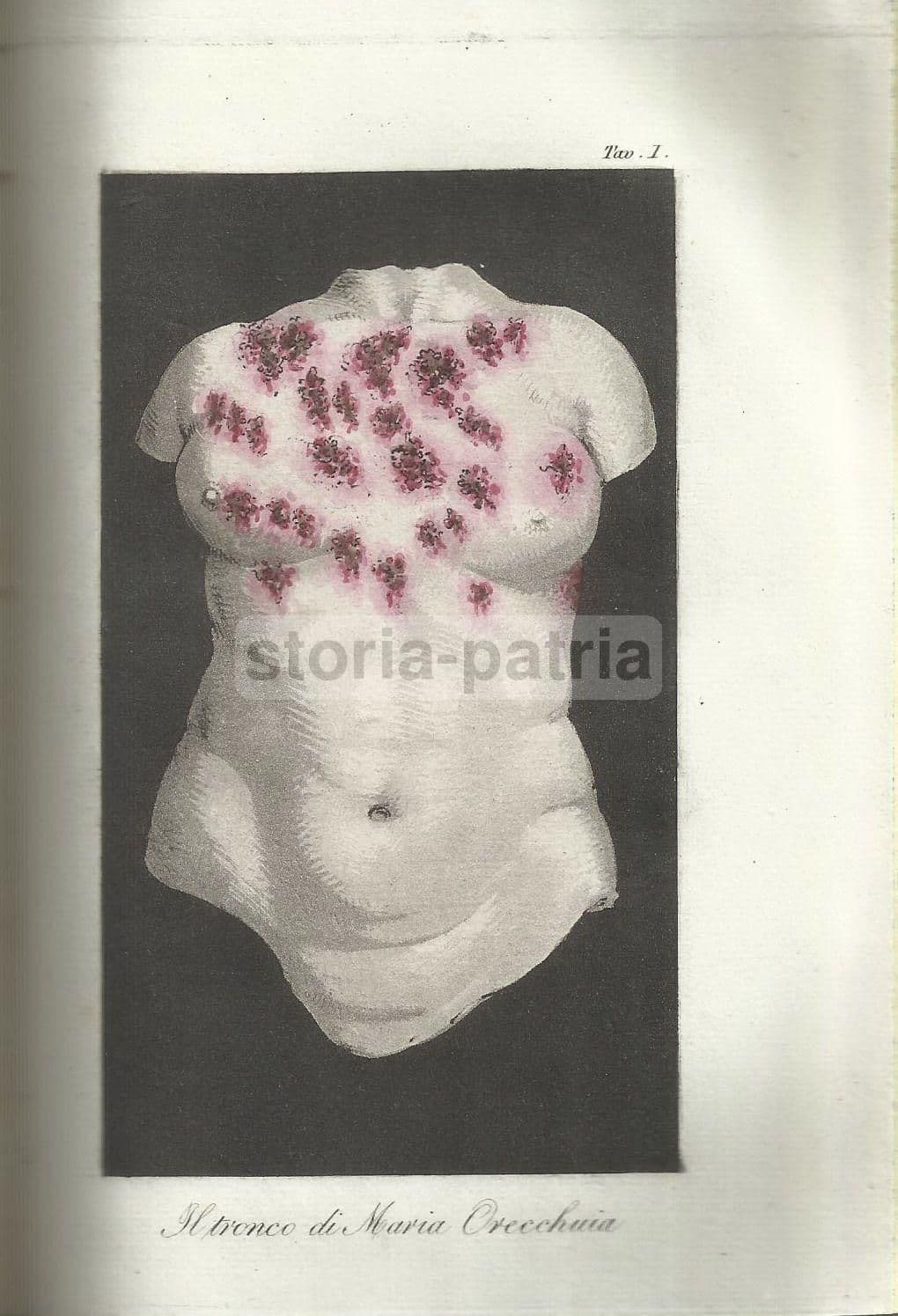 Memorie Medico Chirurgiche Marcolini 1829 Milano Oncologia Veneto