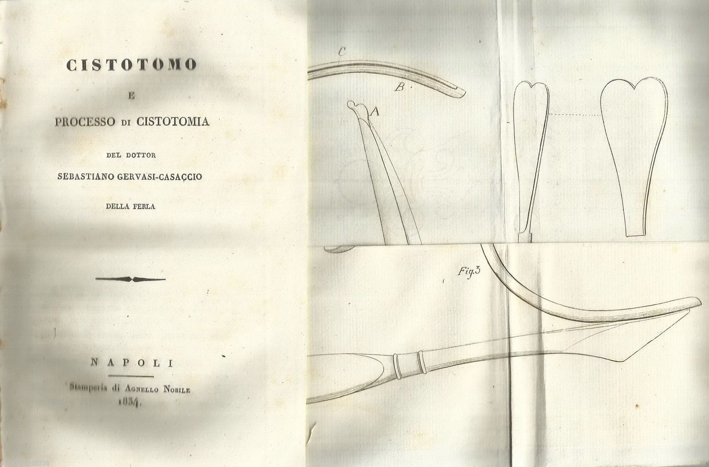 Cistotomo E Processo Di Cistotomia, Gervasi 1834, Chirurgia Urologica