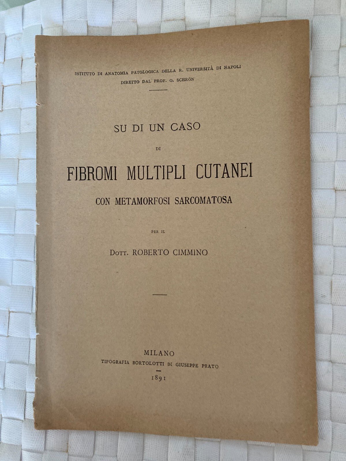 Roberto Cimmino, Sarcoma E Fibroma Multiplo, 1891