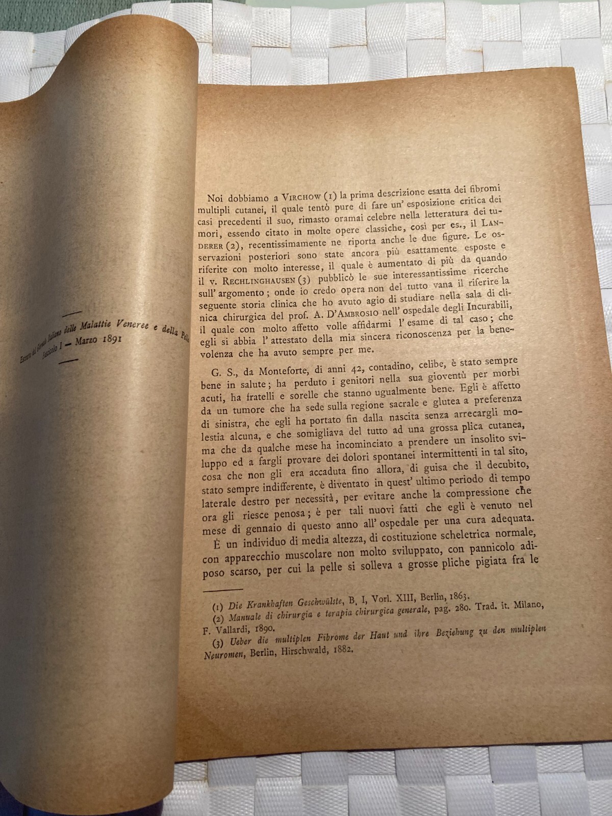 Roberto Cimmino, Sarcoma E Fibroma Multiplo, 1891