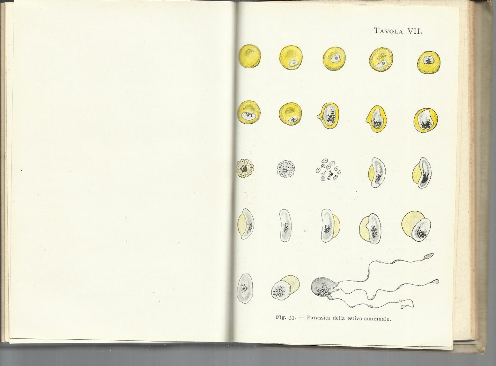 Semeiotica Fisica E Funzionale: Esame Degli Infermi. Umberto Gabbi. Hoepli, 1912