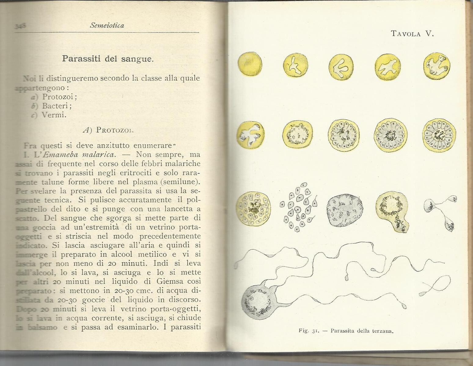 Semeiotica Fisica E Funzionale: Esame Degli Infermi. Umberto Gabbi. Hoepli, 1912