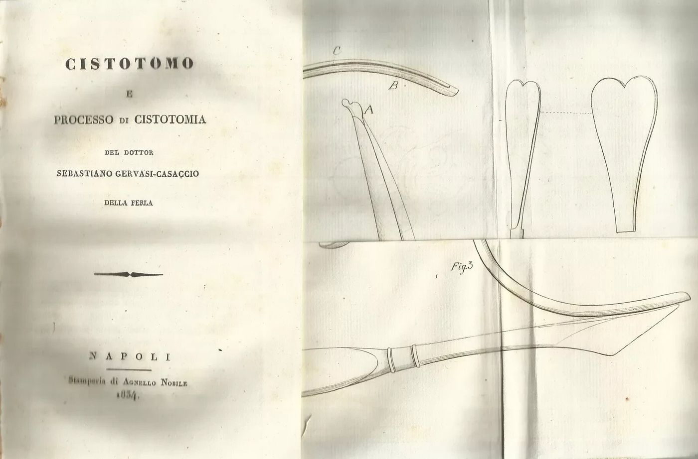 Chirurgia Urologica, Vescica, Prostata, Cistotomia. Gervasi, Casaccio Della Ferla. 1834