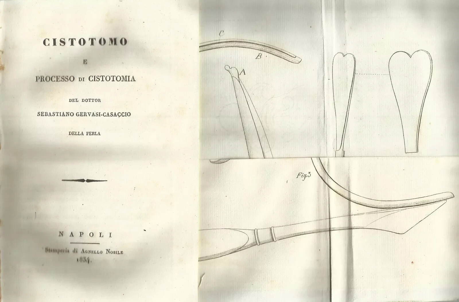 Chirurgia Urologica, Vescica, Prostata, Cistotomia. Gervasi, Casaccio Della Ferla. 1834