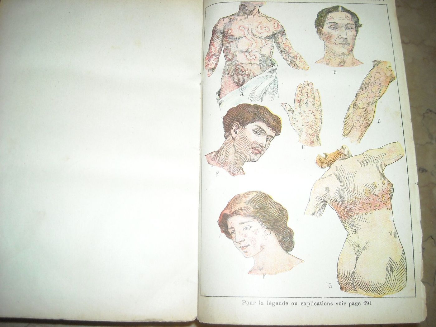 Medicina Vegetale, Farmacia, Terapie E Botanica: Livre De Santé Et d'Hygiène Di A. Narodetzki