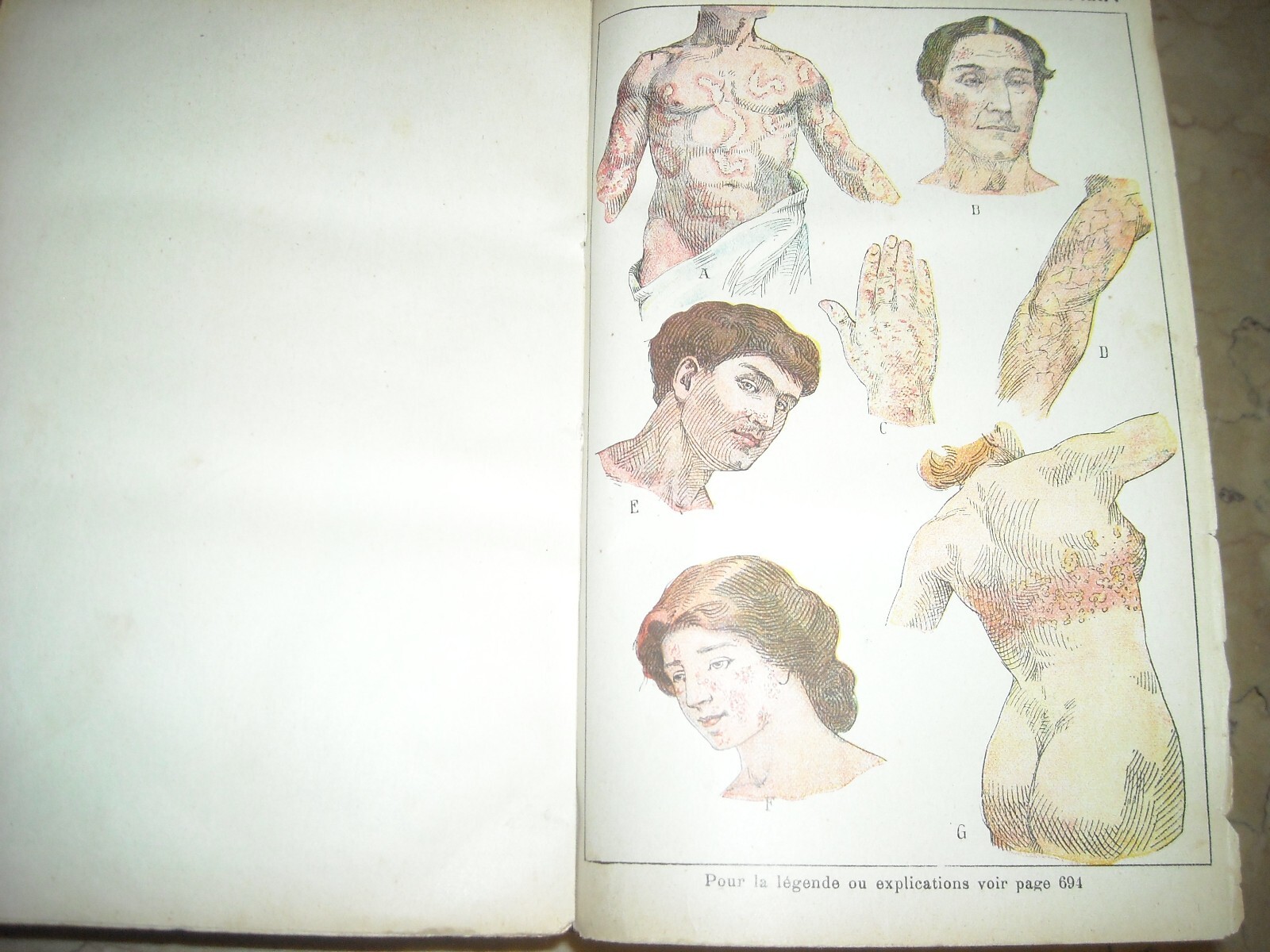 Medicina Vegetale, Farmacia, Terapie E Botanica: Livre De Santé Et d'Hygiène Di A. Narodetzki