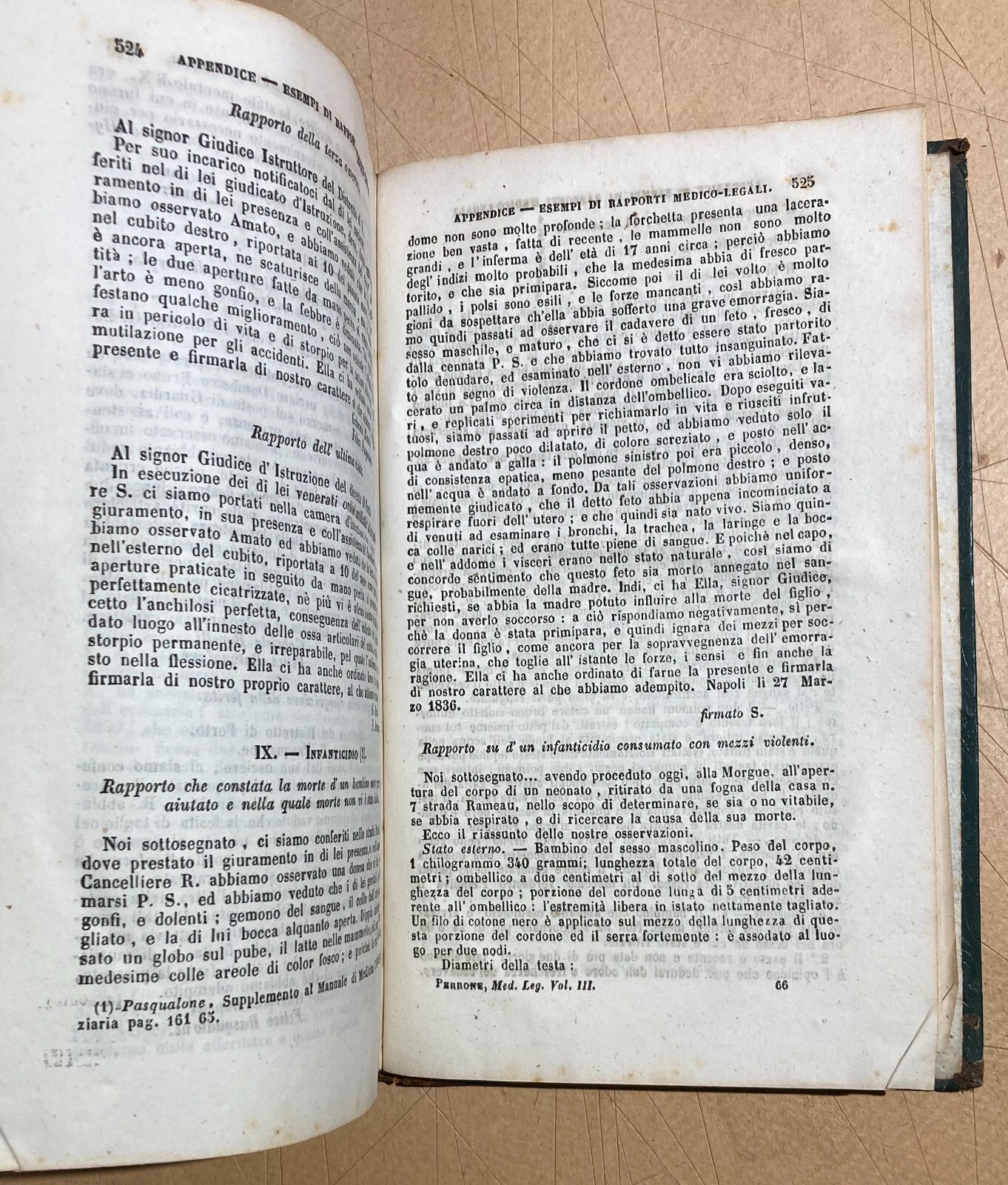 Medicina Legale   Perrone   Napoli   Putrefazione   Tossicologia   1851