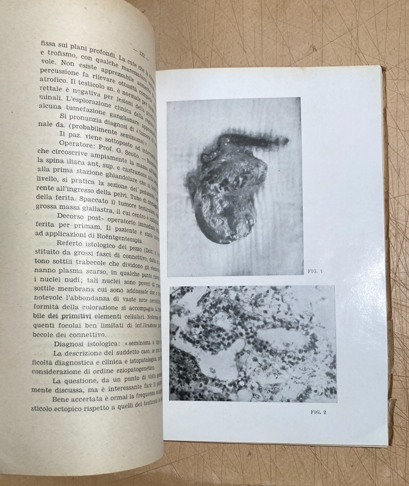 Abruzzo, Chieti: Atti Del III Convegno Medico (1951)