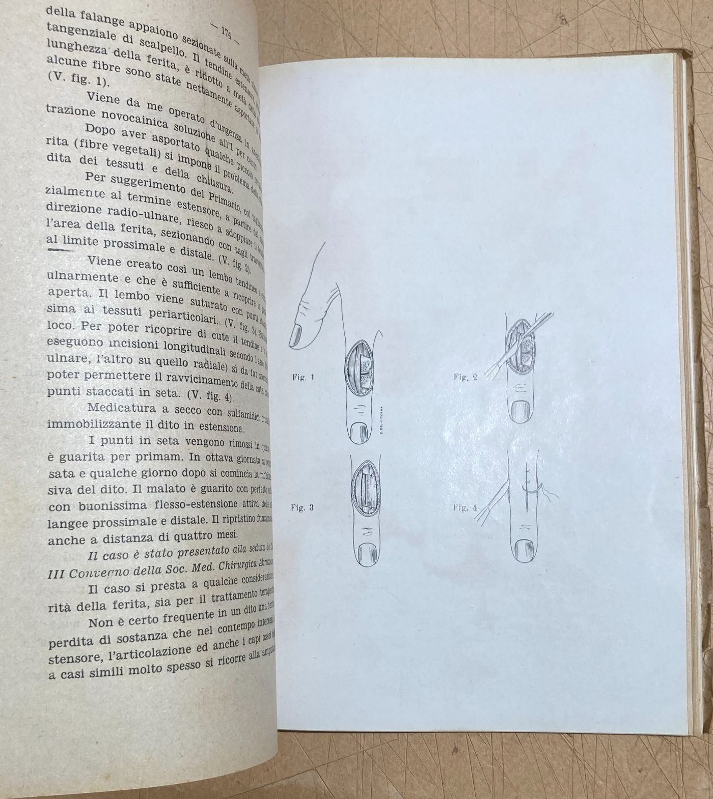 Abruzzo, Chieti: Atti Del III Convegno Medico (1951)
