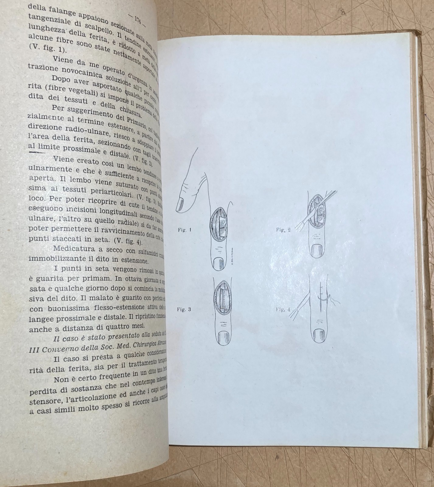 Abruzzo, Chieti: Atti Del III Convegno Medico (1951)