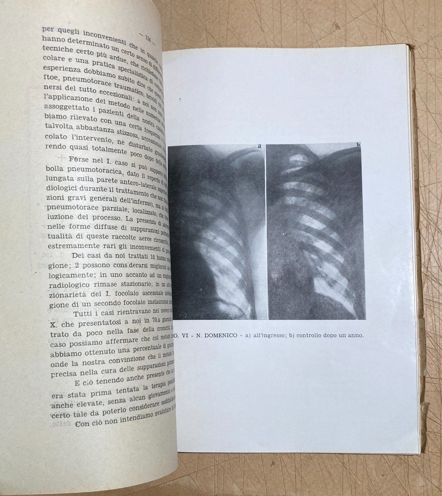 Abruzzo, Chieti: Atti Del III Convegno Medico (1951)
