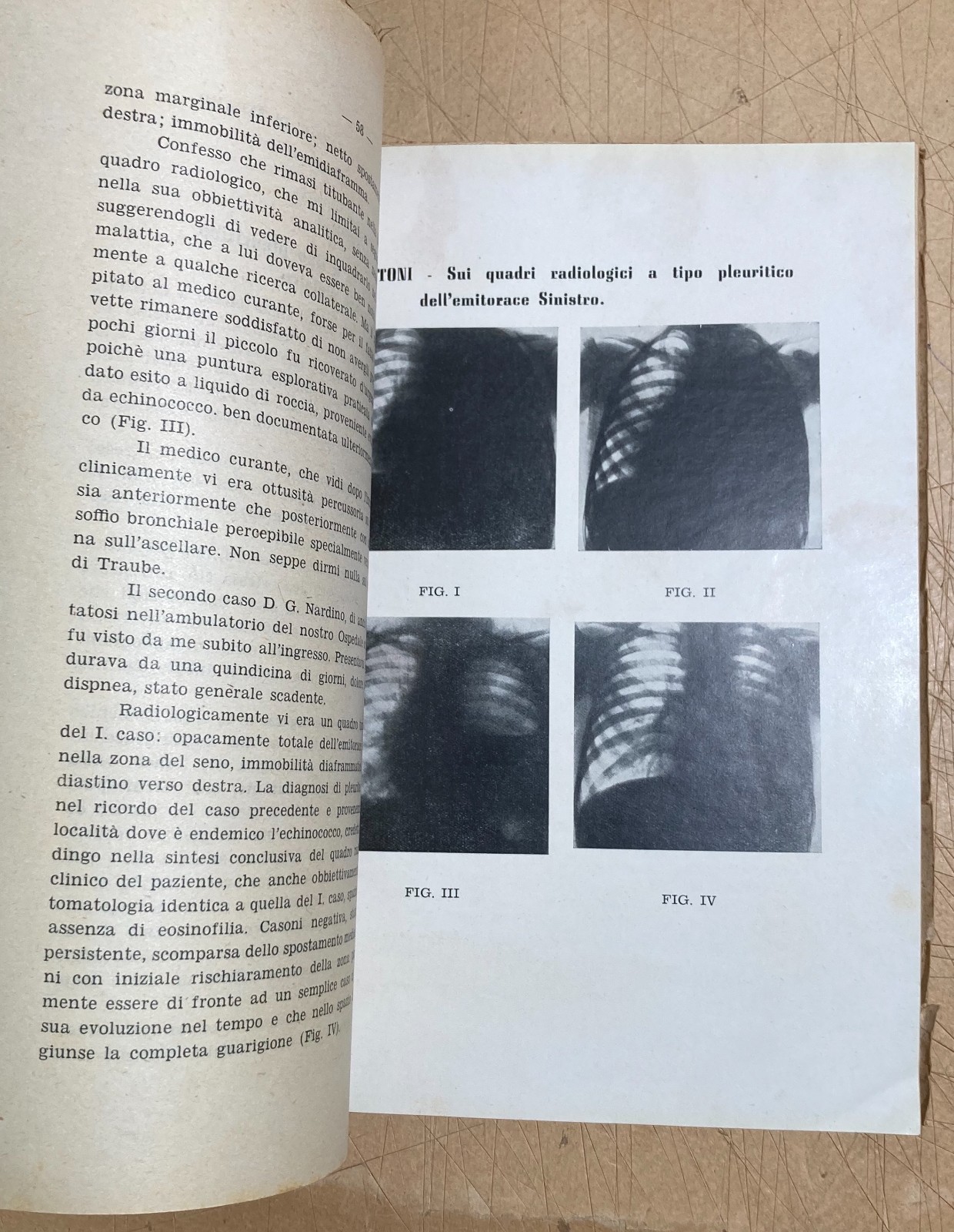 Abruzzo, Chieti: Atti Del III Convegno Medico (1951)