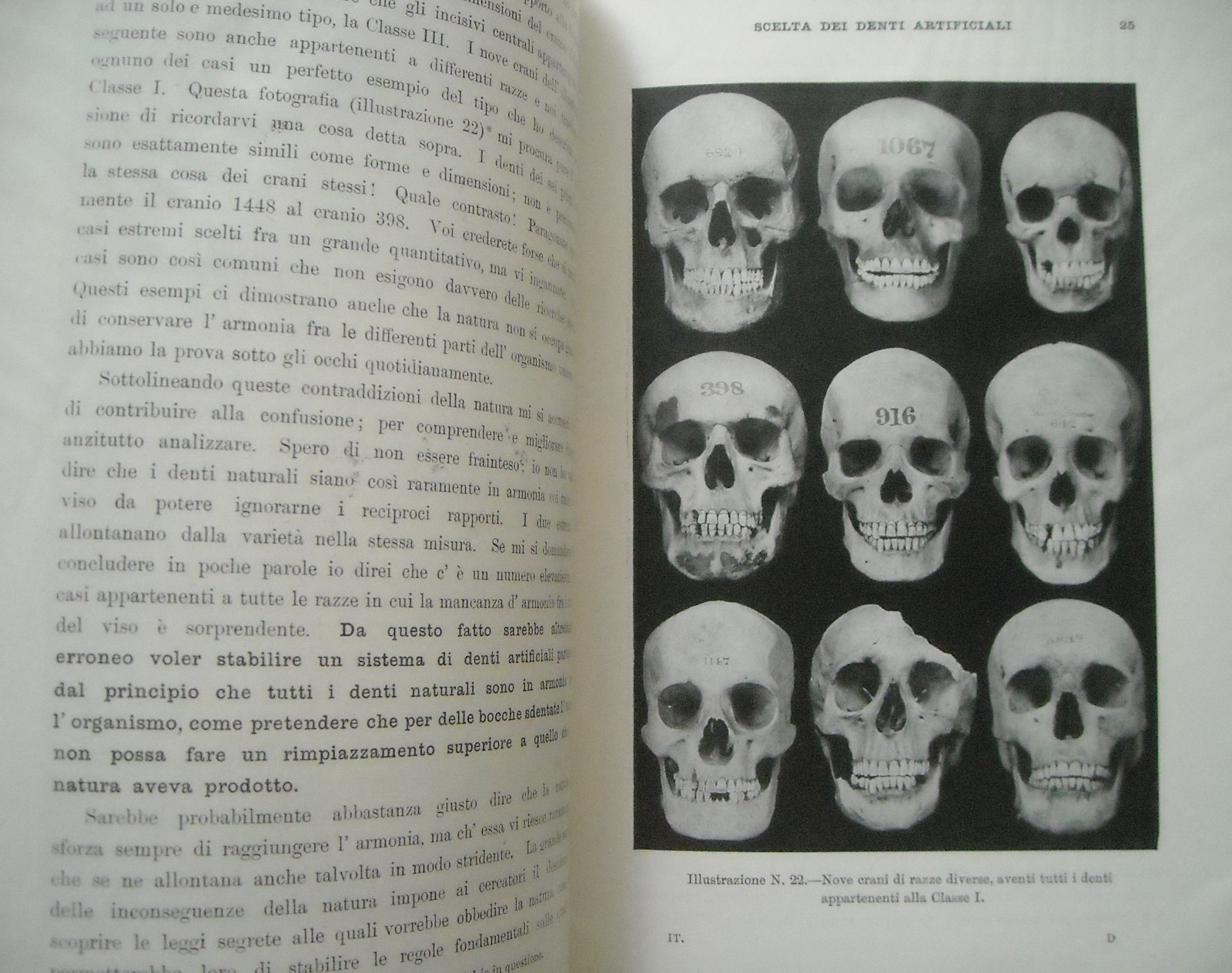 Medicina, Odontoiatria E Antropologia Della Dentatura Umana: Scelta Dei Denti Artificiali