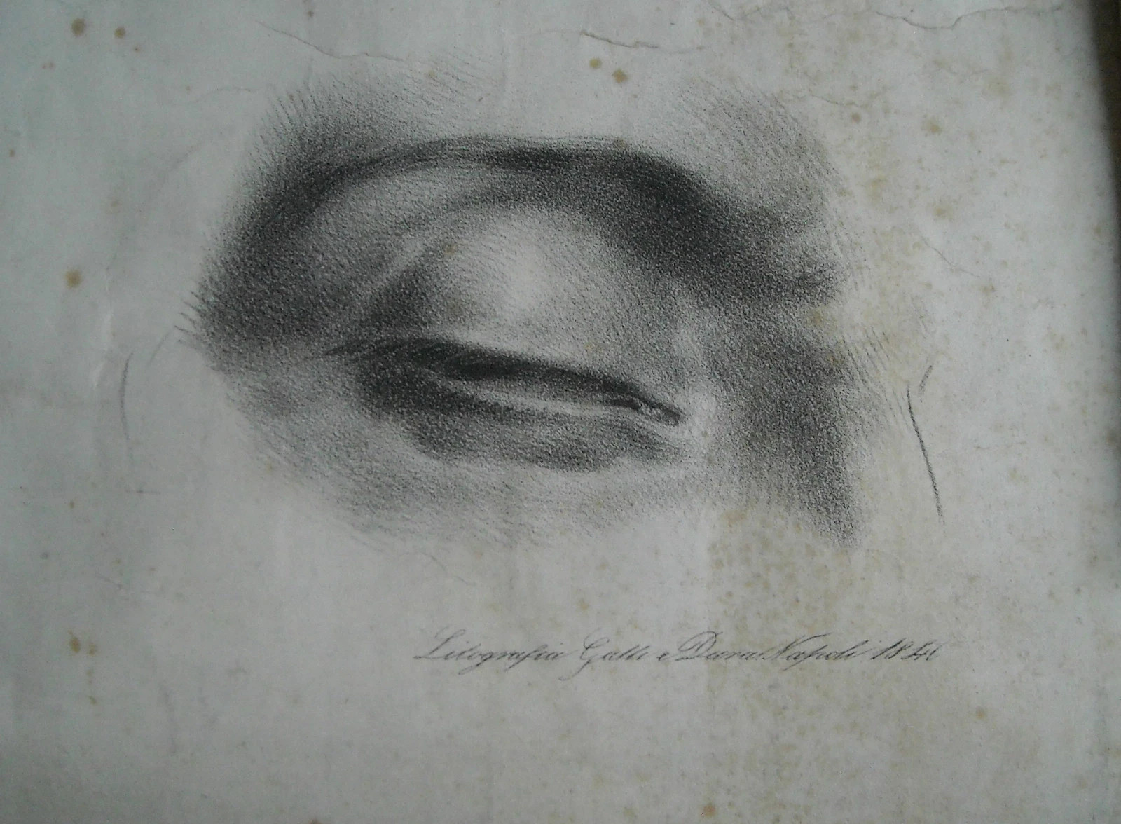 Medicina Oculistica: Occhio E Palpebre. Antica Grande Litografia, Napoli, Dura, 1840