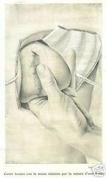 Medicina, Chirurgia d'Urgenza, Anestesia E Salasso. Due Volumi Di Felice Lejars