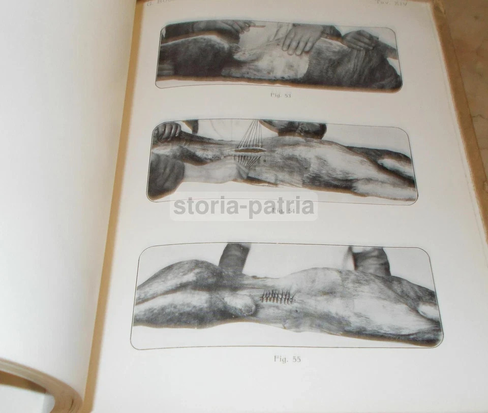 Trattato Di Chirurgia d'Urgenza Di Felice Lejars   Medicina E Chirurgia Illustrata