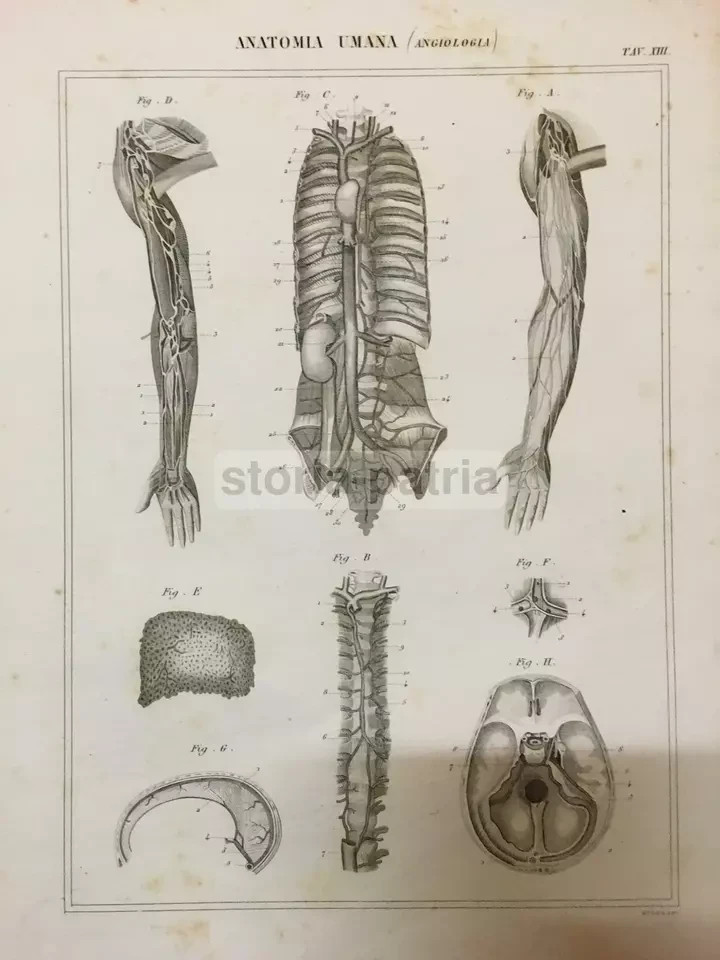 Medicina Angiologia: Circolazione Del Sangue, Torace, Arti, Cranio, Addome, XIX Secolo
