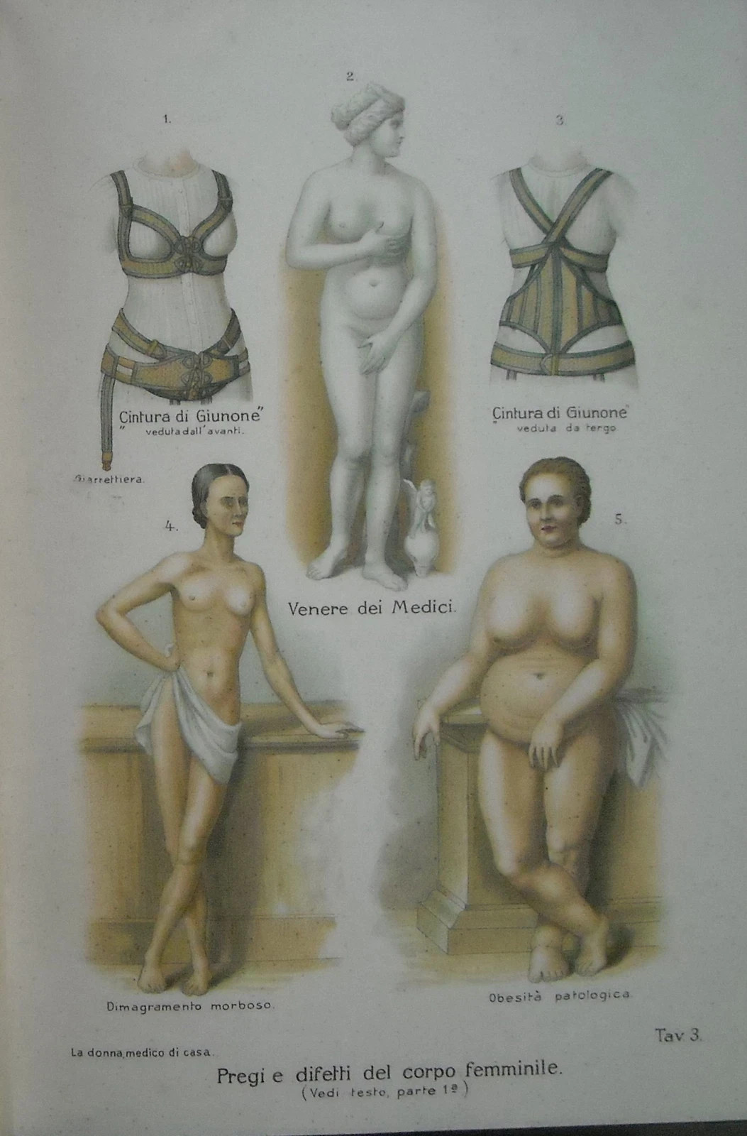 Medicina: Corpo Femminile, Obesità, Dimagrimento, Estetismo, Venere Medicea E Cinture