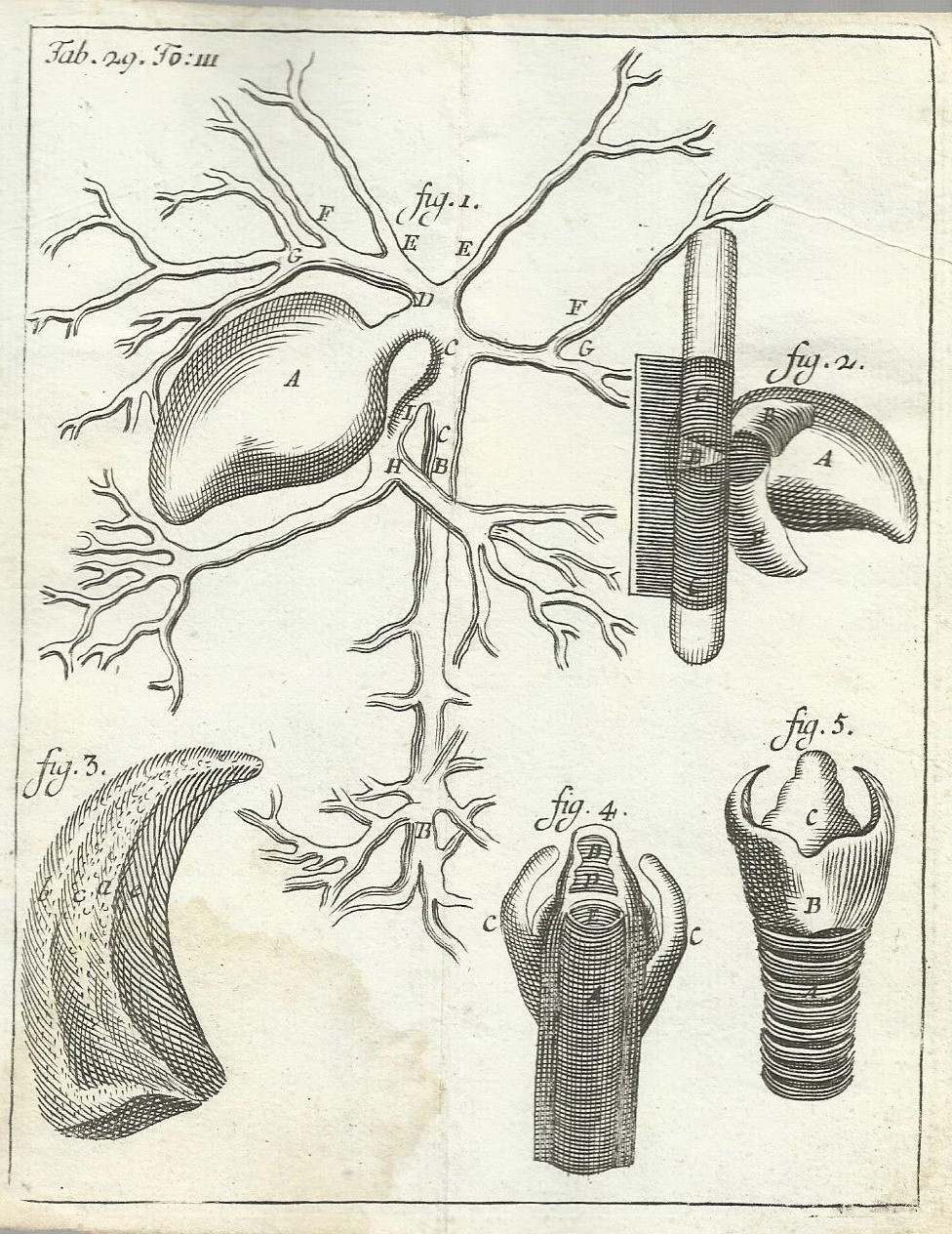 Medicina: Anatomia Dell'Apparato Respiratorio O Bronchiale. Antica Stampa Del '700