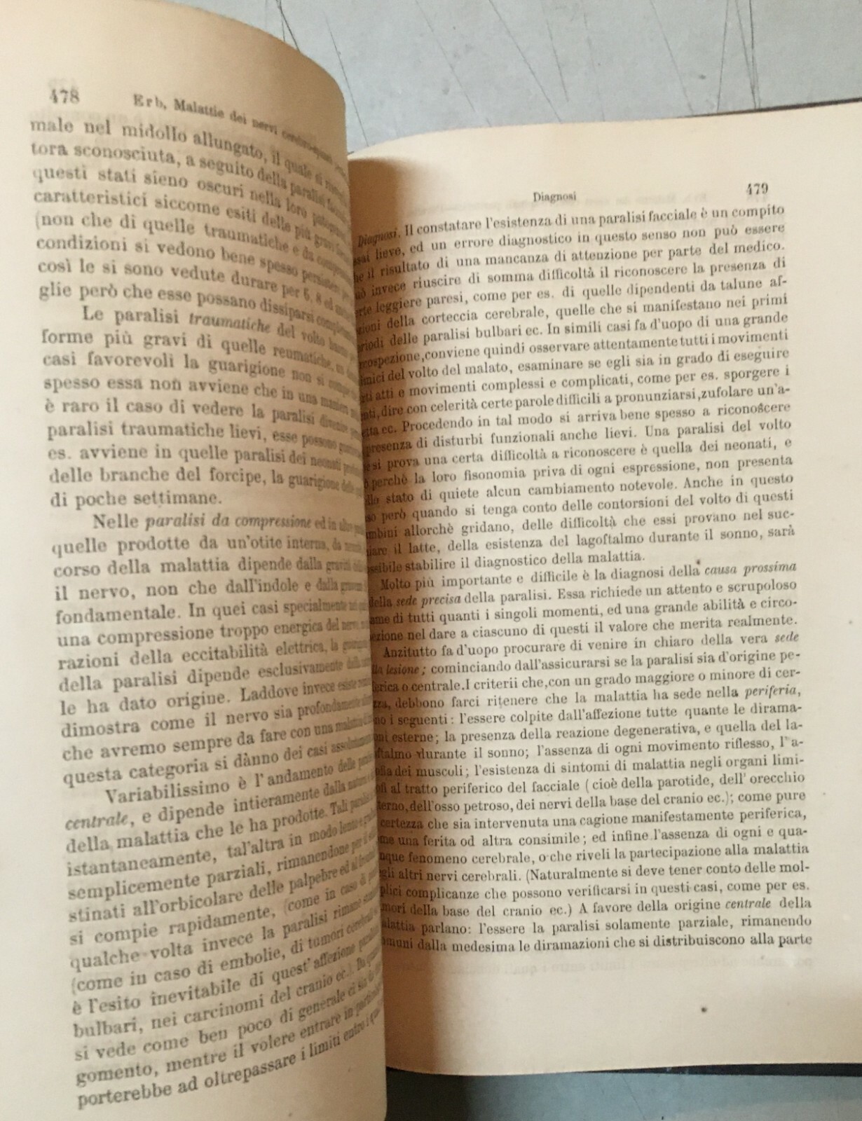 Medicina, Neurologia, Nervi: Malattie Del Sistema Nervoso   Erb, De Renzi, Crapols, 1877