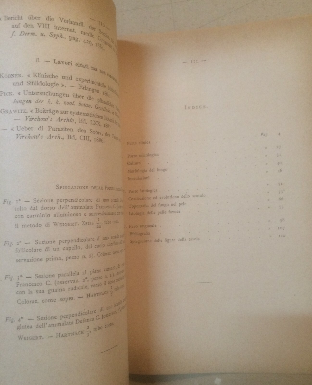 Medicina: Dermatologia, Favo E Tigna In Sardegna. Mibelli, 1892
