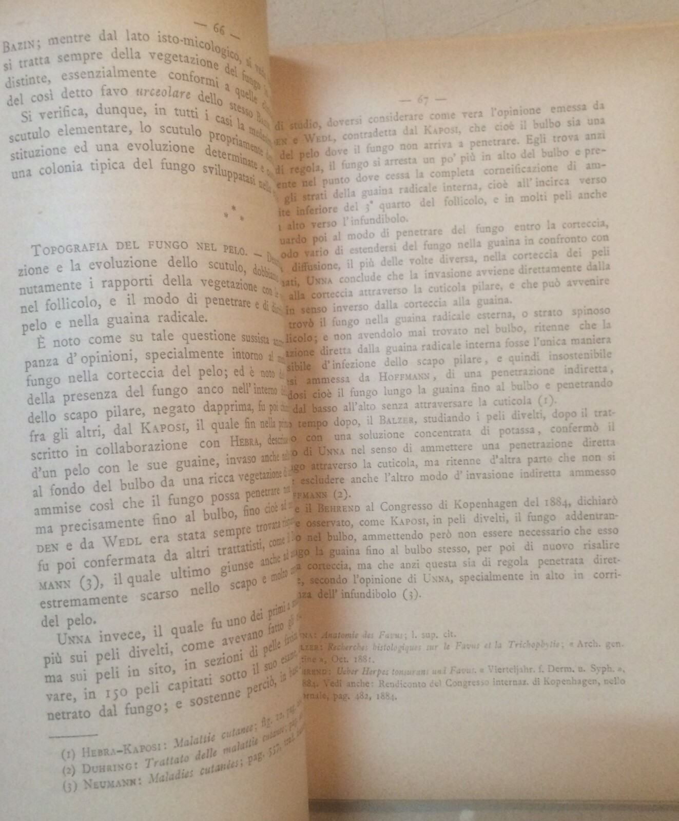 Medicina: Dermatologia, Favo E Tigna In Sardegna. Mibelli, 1892