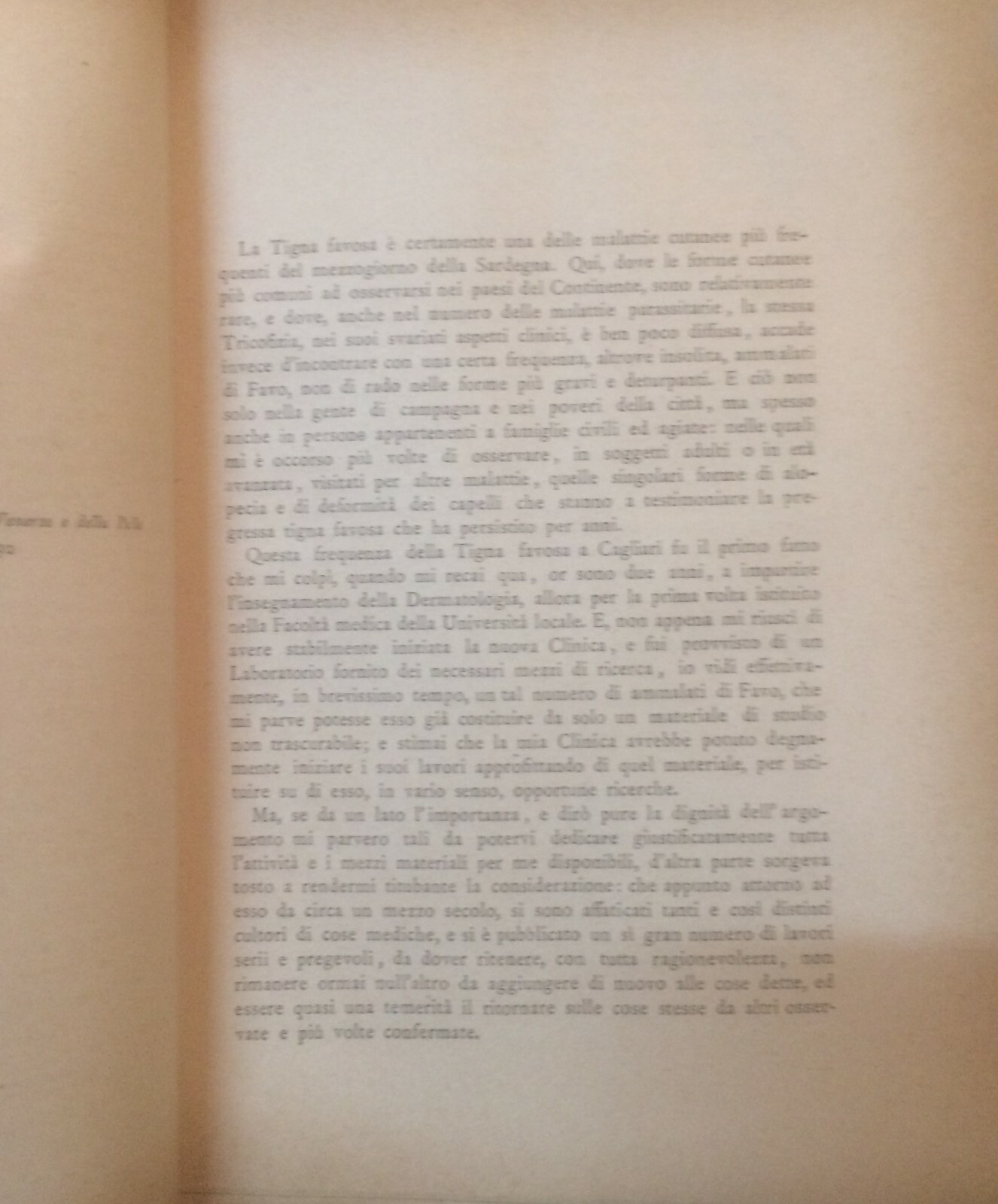Medicina: Dermatologia, Favo E Tigna In Sardegna. Mibelli, 1892