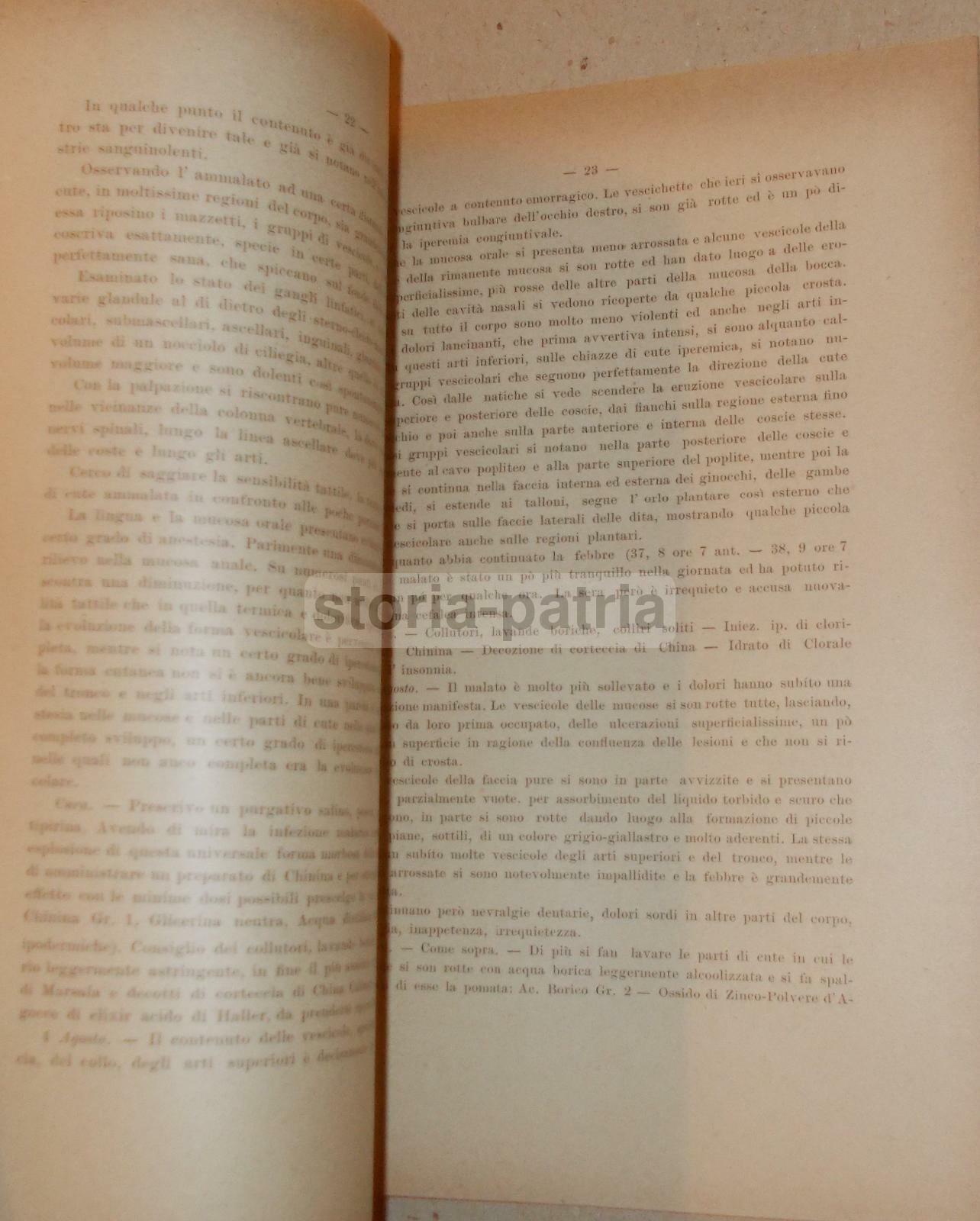 Medicina, Dermatologia: Herpes Zoster, Colombini, Con Due Tavole A Colori, Siena, 1893