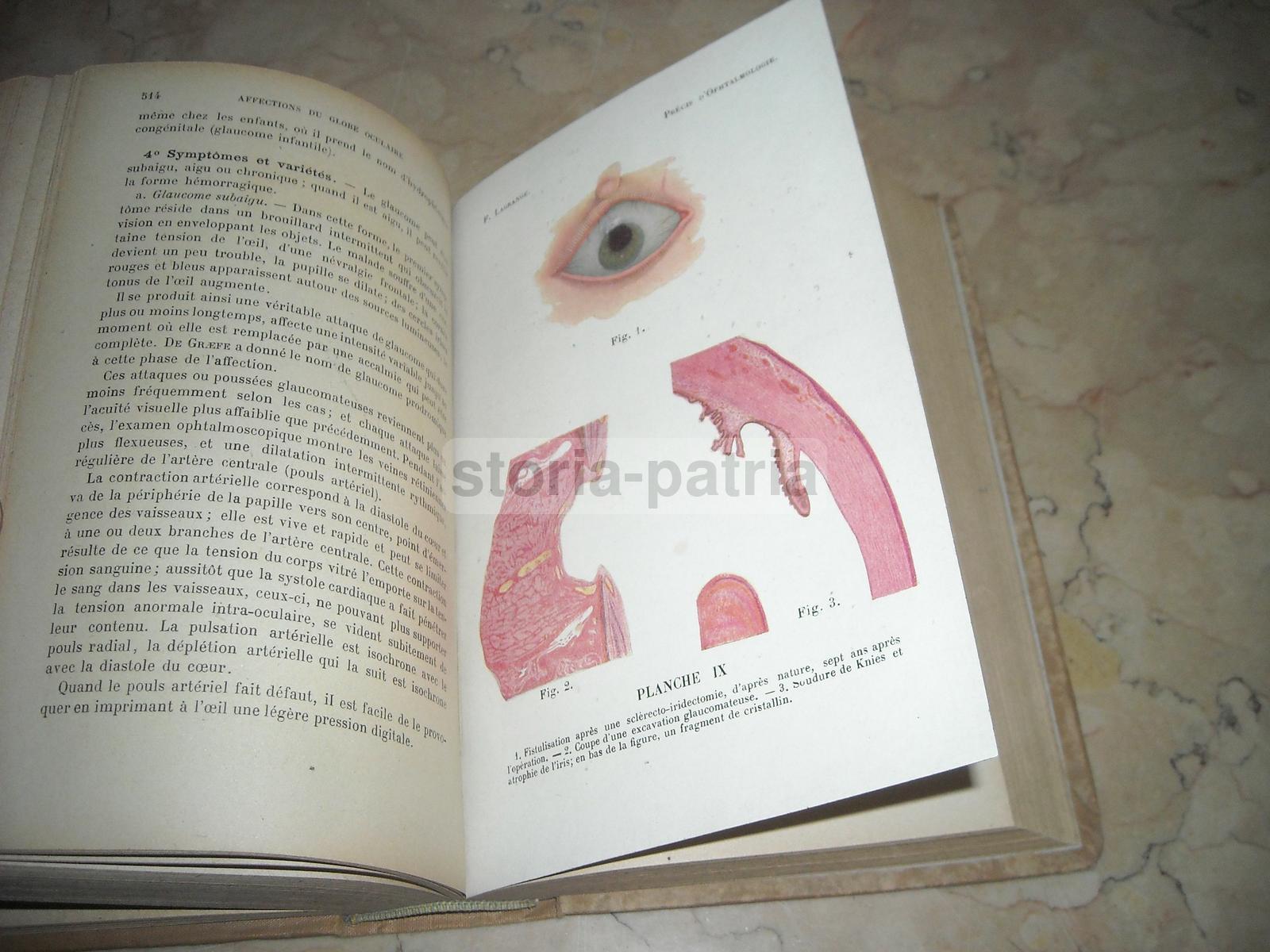 Medicina Oculistica: Précis d'Ophtalmologie Di Felix Lagrange, 1921