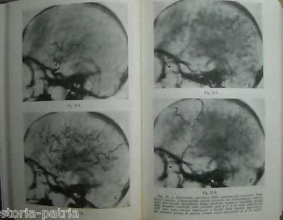 Medicina Oculistica: Occhio, Retina, Oftalmodinamometria, Neurologia, Angiologia, 1965