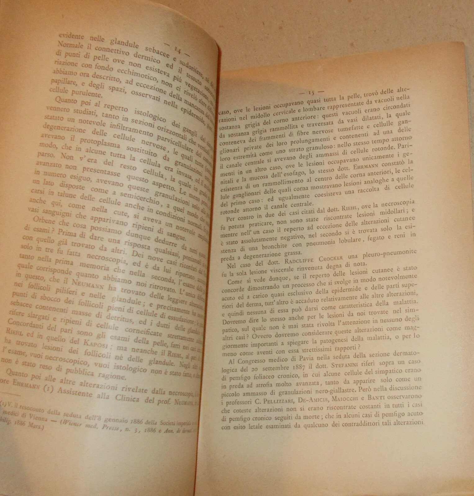 Medicina: Pemfigo Vegetante, Dr. Marianelli, Pisa, Clinica Dermo Sifilopatica, 1889