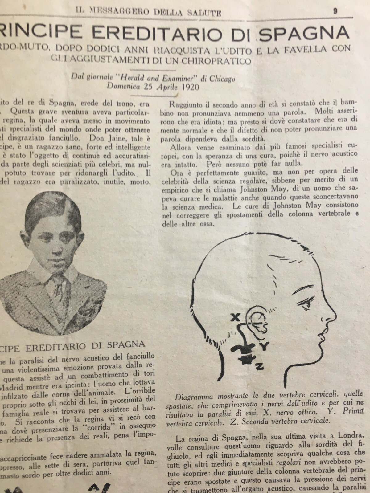 Medicina Alternativa, Osteopatia, Naturopatia, Chiropratica Ed Emigrazione A Chicago (1920)