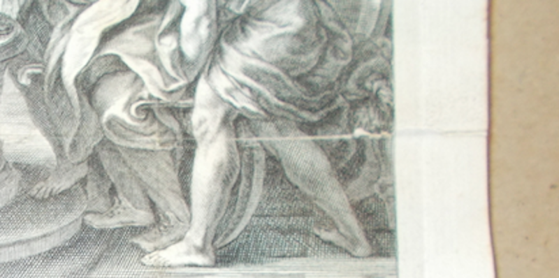 Arte, Devozione, Medicina: Podagra E Gotta. Antica Scenografia Di S. Giuliano, Gaulli, Frey