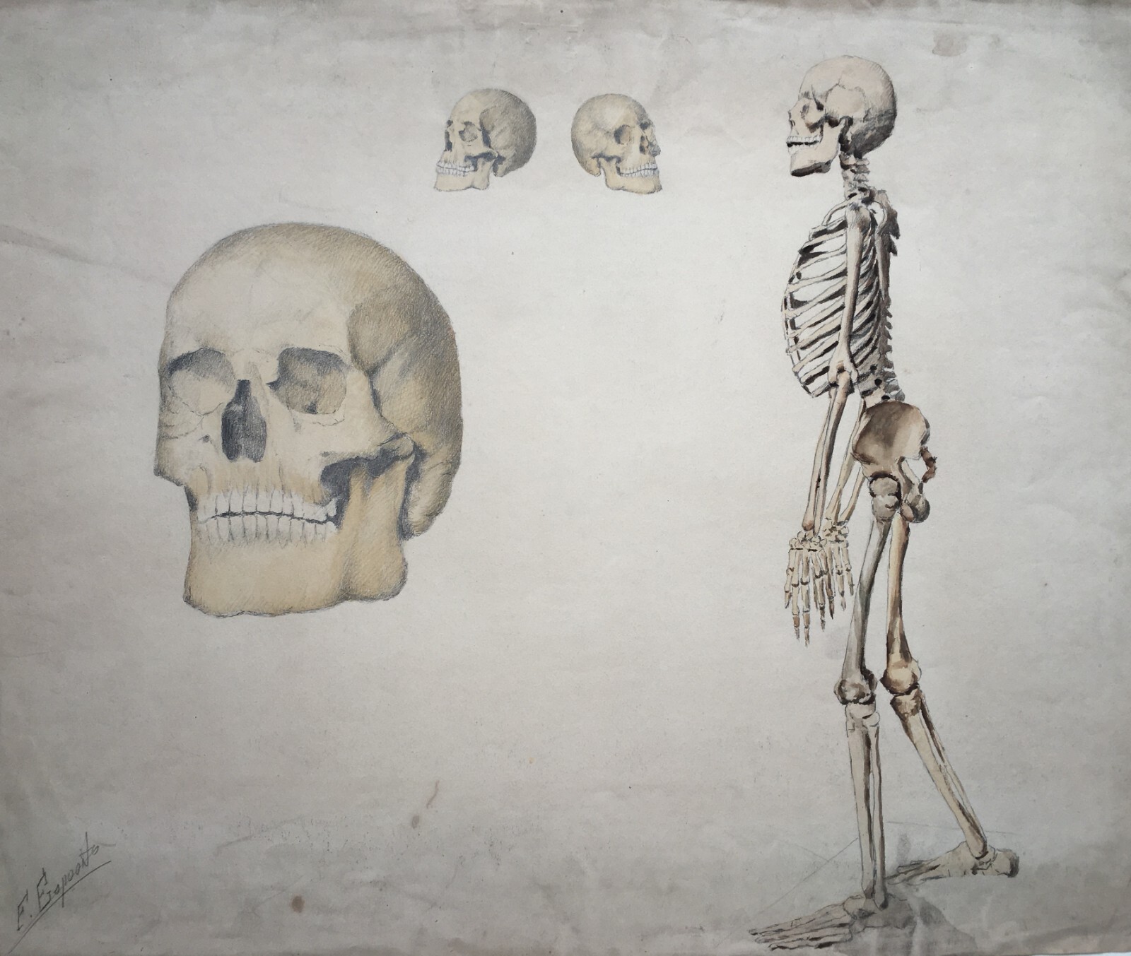 Scheletro E Teschio, Studio Anatomico. Disegno Acquarellato Di F. Esposito.