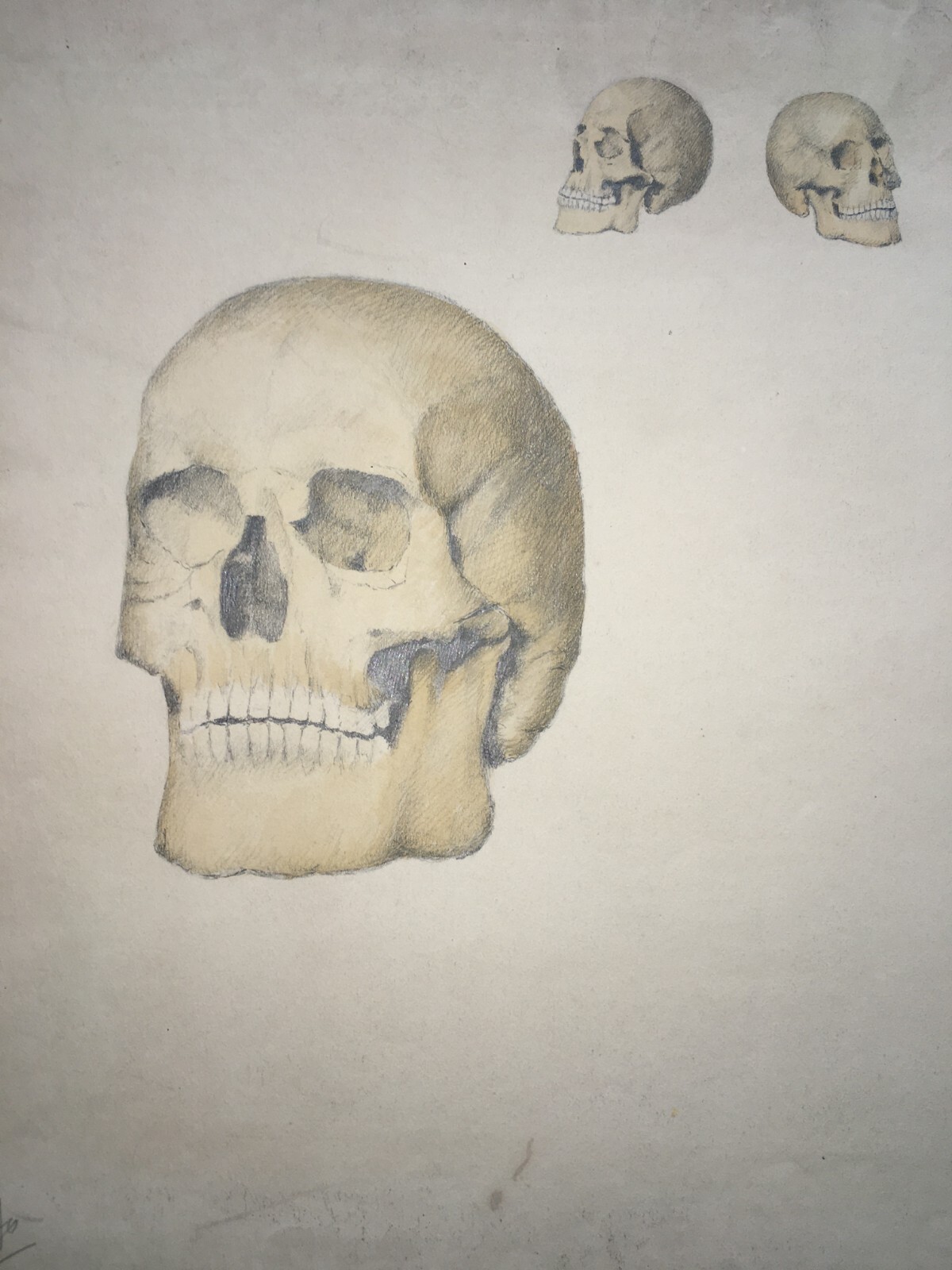 Scheletro E Teschio, Studio Anatomico. Disegno Acquarellato Di F. Esposito.