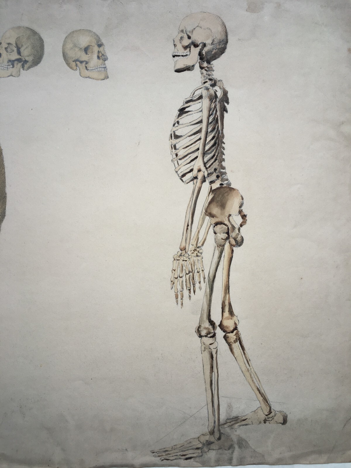 Scheletro E Teschio, Studio Anatomico. Disegno Acquarellato Di F. Esposito.