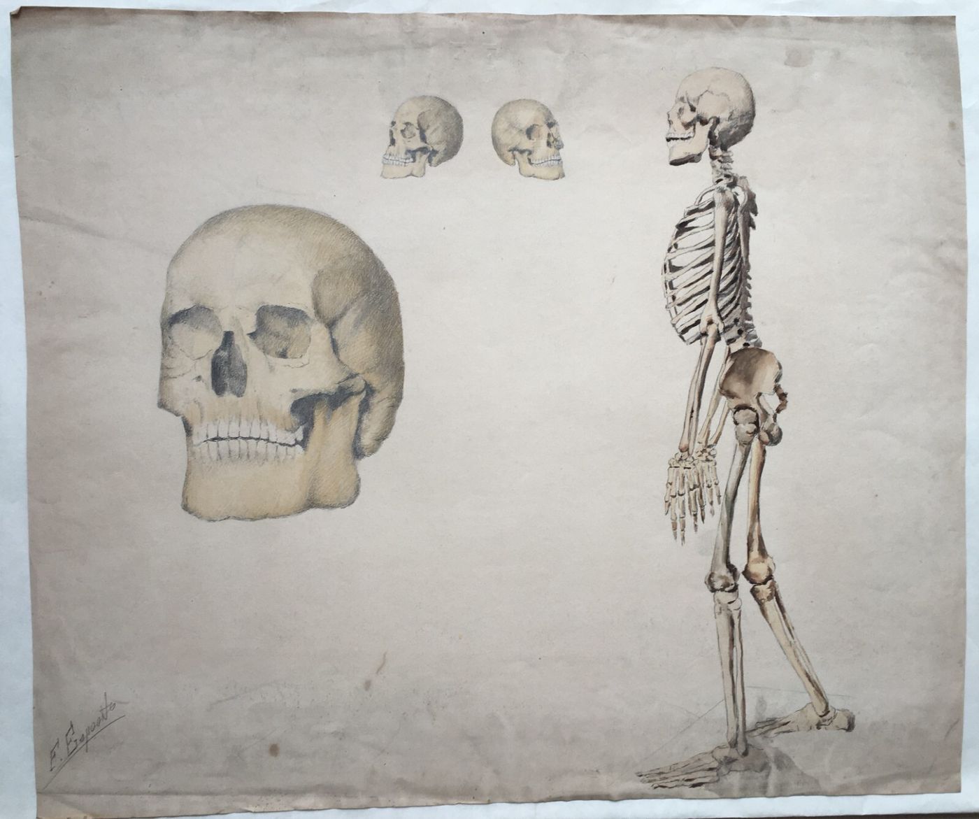 Scheletro E Teschio, Studio Anatomico. Disegno Acquarellato Di F. Esposito.