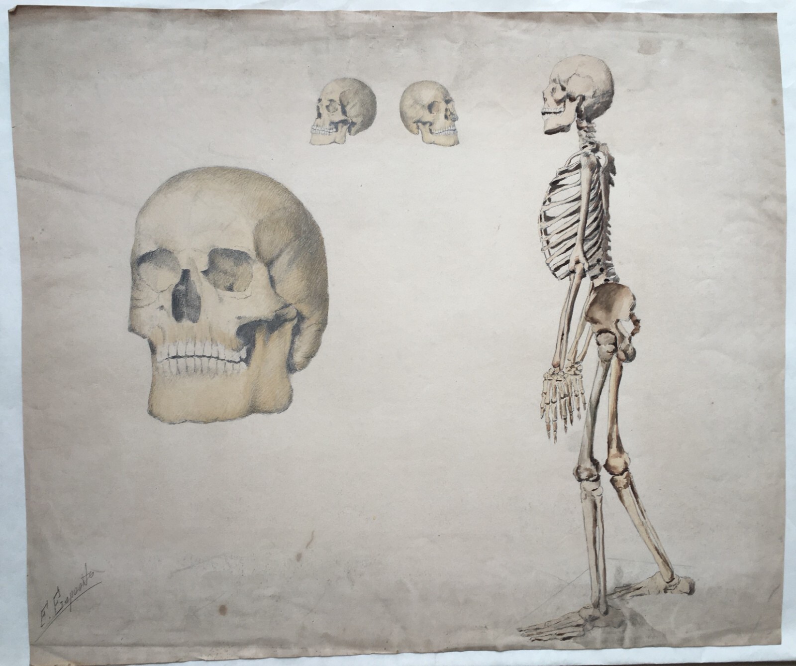 Scheletro E Teschio, Studio Anatomico. Disegno Acquarellato Di F. Esposito.