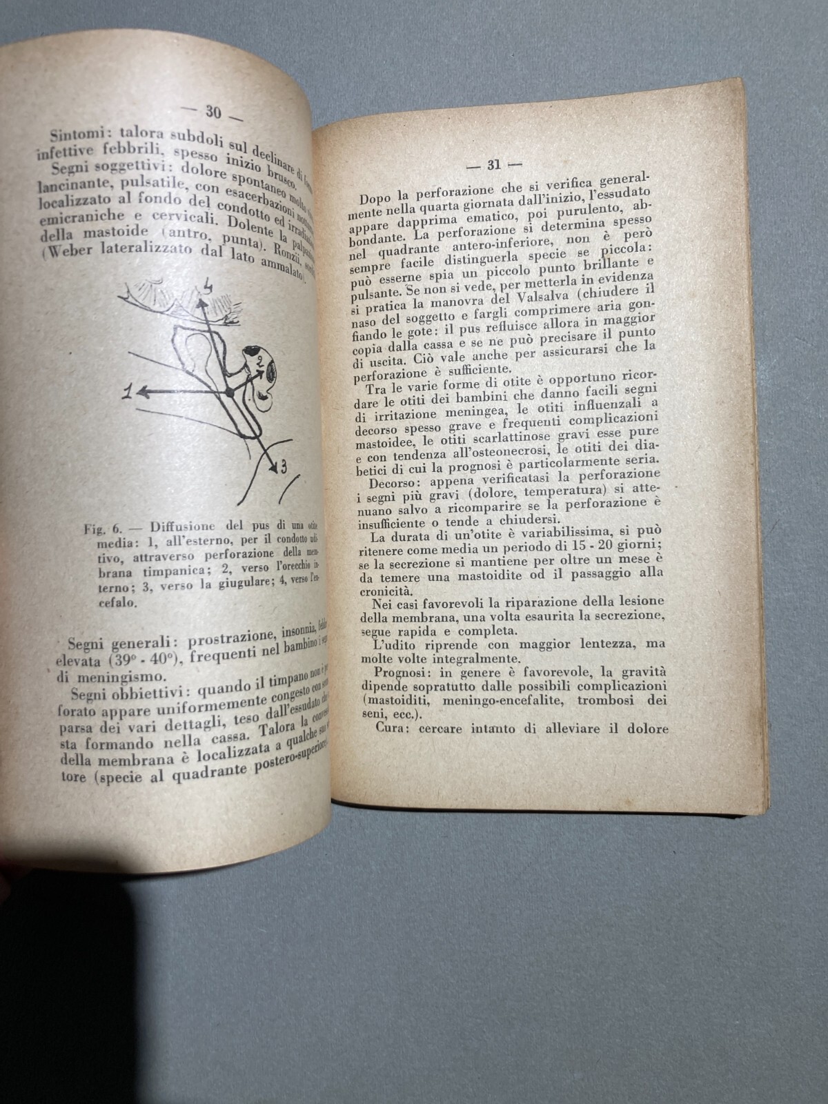 Medicina: Otorinolaringoiatria (naso, Faringe, Laringe, Otiti, Faringiti). Sanvenero Rosselli, 1930