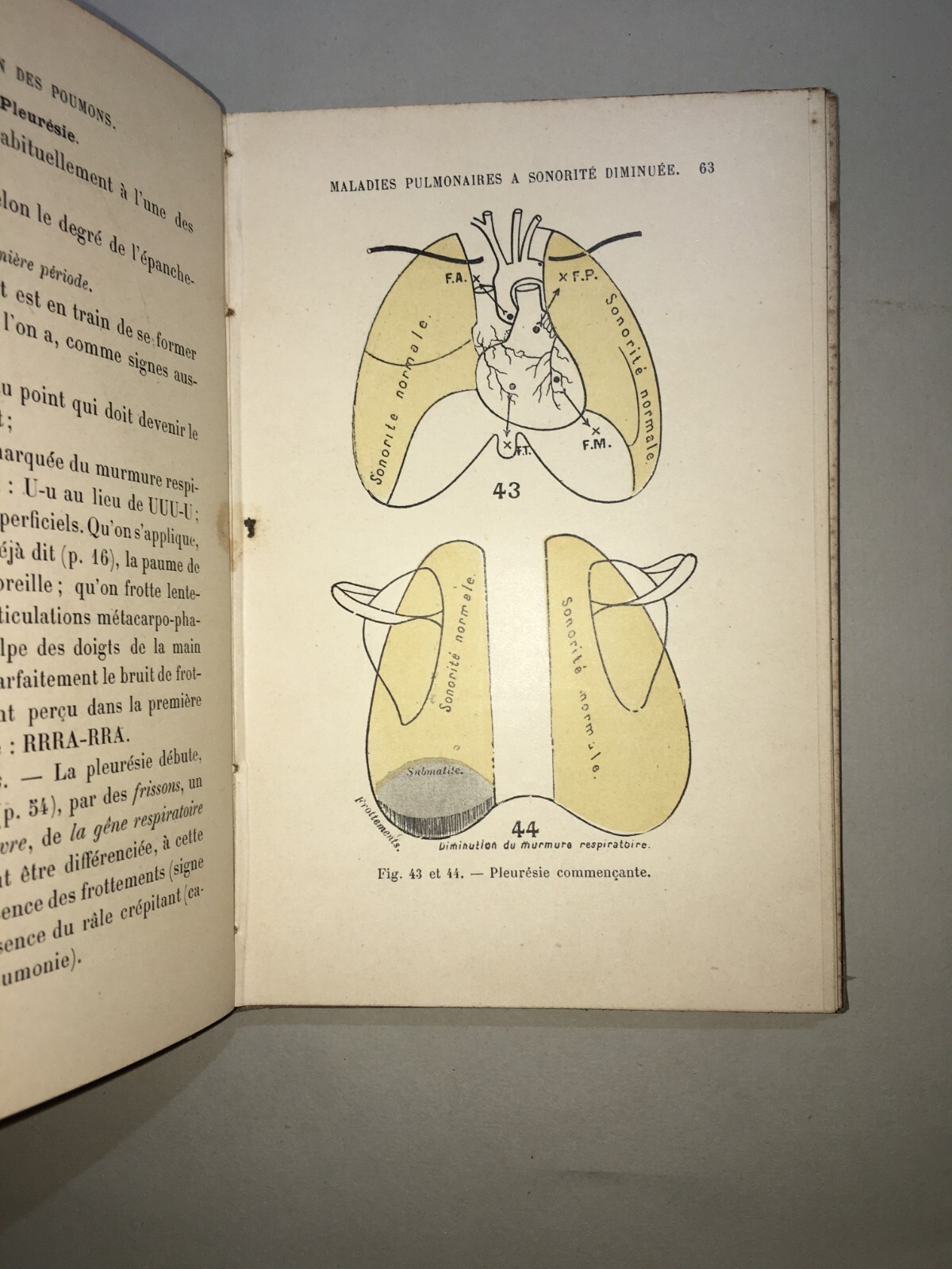 Medicina: Cardiologia, Ascoltazione Del Cuore E Pneumologia. Dr. Coiffier, 1897