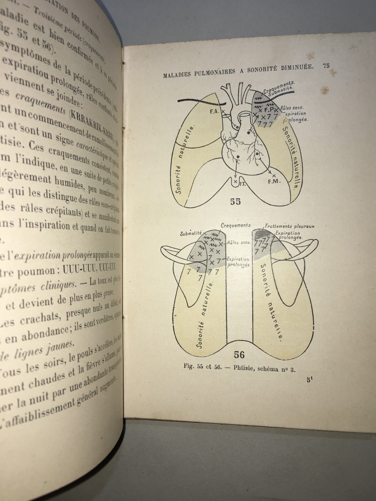 Medicina: Cardiologia, Ascoltazione Del Cuore E Pneumologia. Dr. Coiffier, 1897
