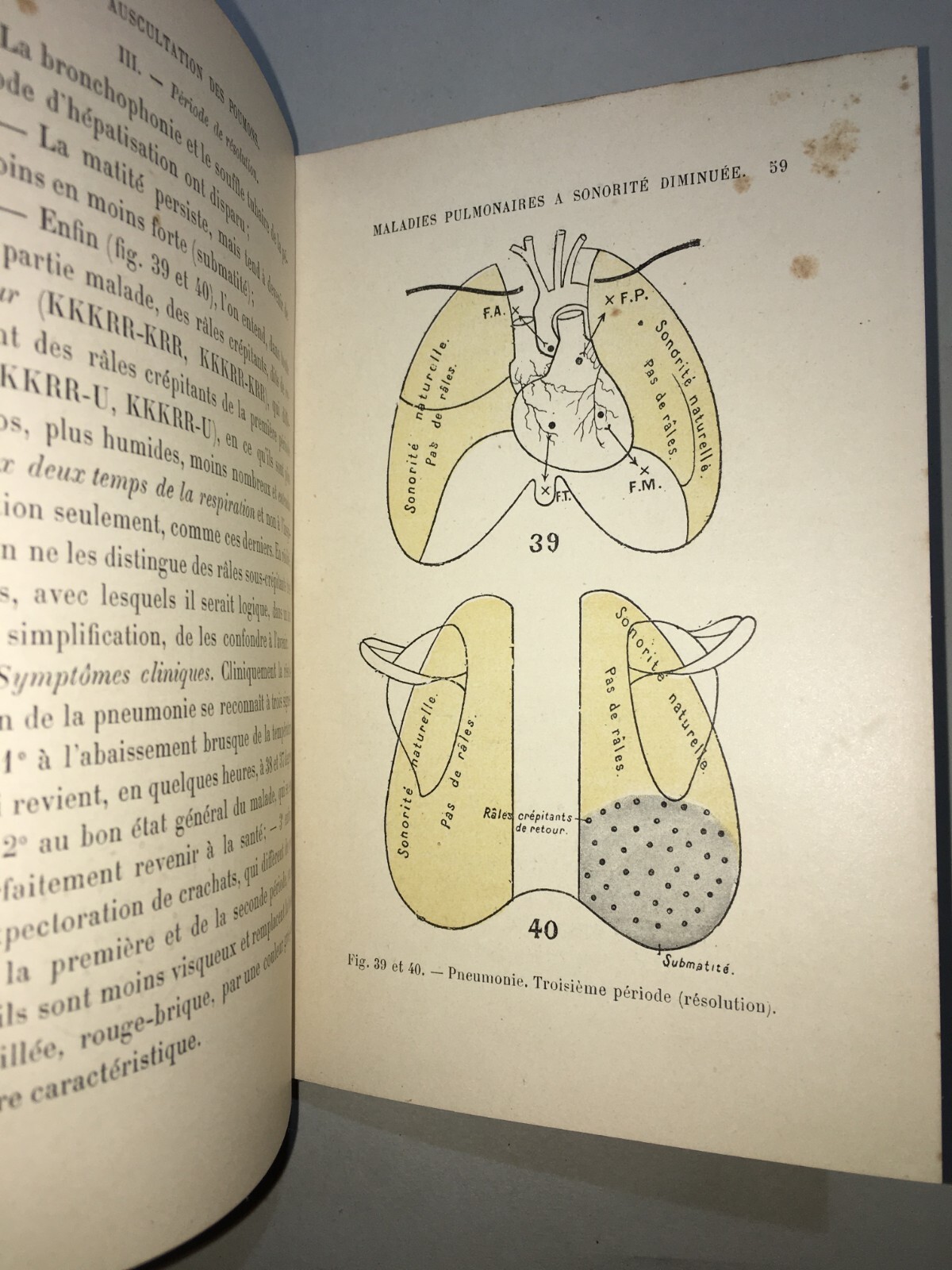Medicina: Cardiologia, Ascoltazione Del Cuore E Pneumologia. Dr. Coiffier, 1897