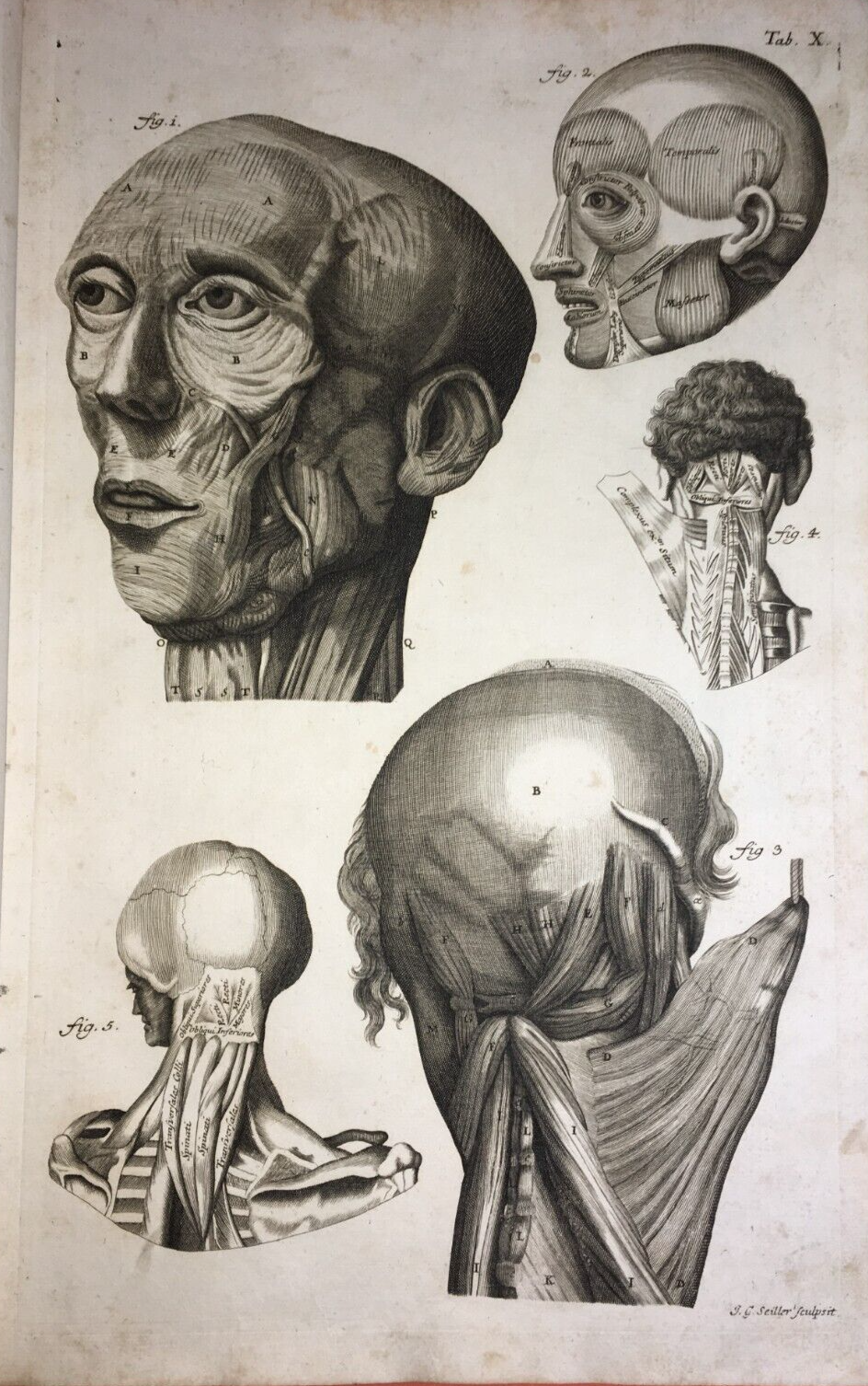 Medicina, Anatomia Umana: Muscolatura Di Testa E Collo. Artista Seiller, XVIII Secolo