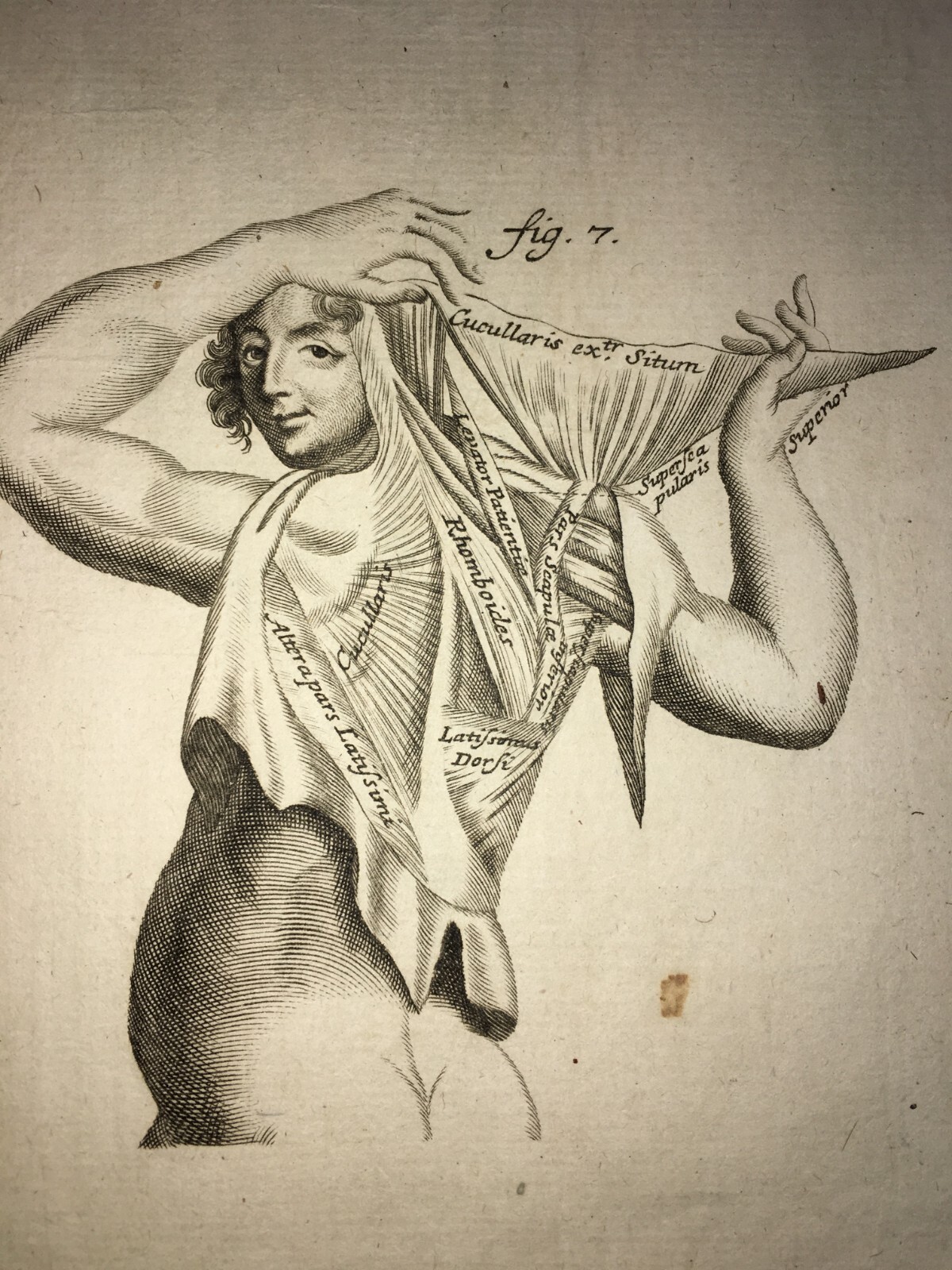 Medicina: Anatomia Umana. Muscolatura Di Collo E Tronco. Artista: Seiller. Incisione