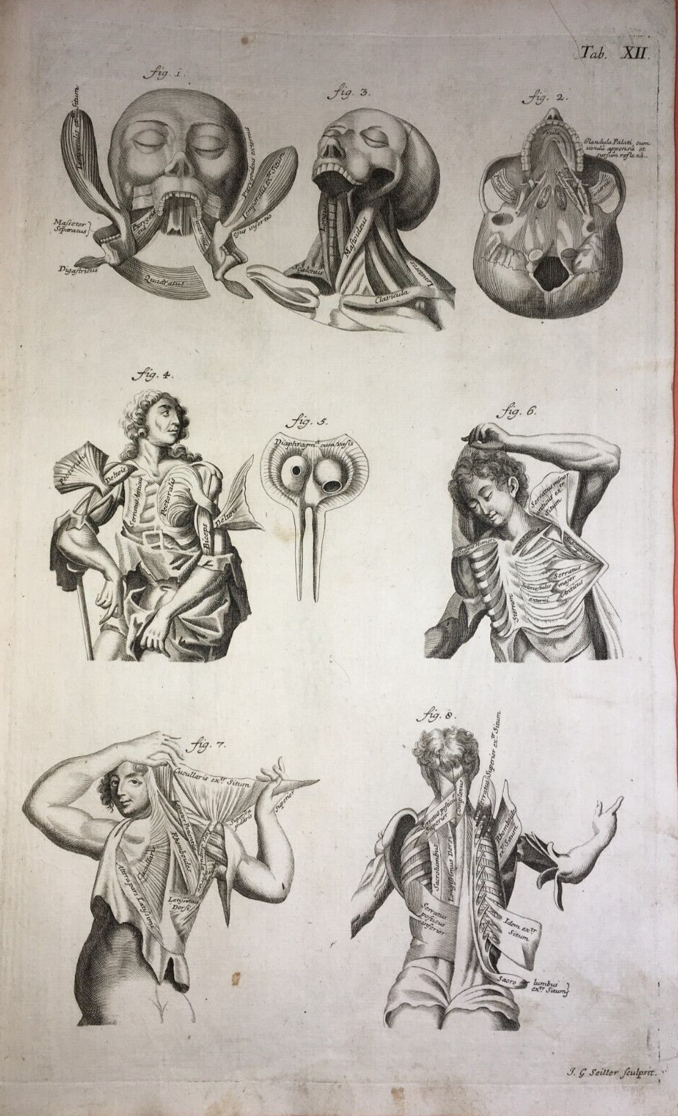 Medicina: Anatomia Umana. Muscolatura Di Collo E Tronco. Artista: Seiller. Incisione