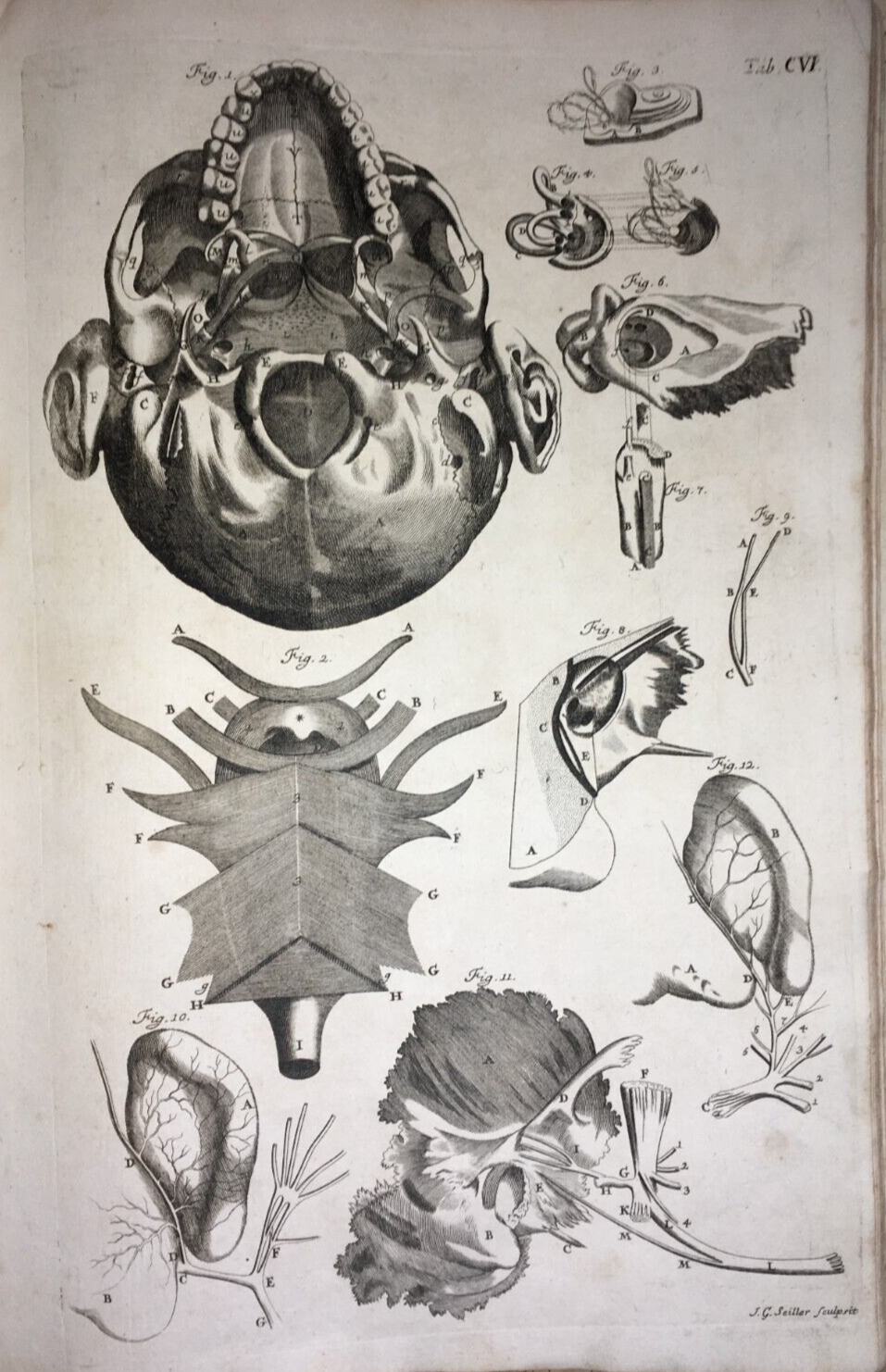 Medicina: Anatomia Umana, Organi Della Gola E Del Collo. Incisione Di Seiller, XVIII Secolo.
