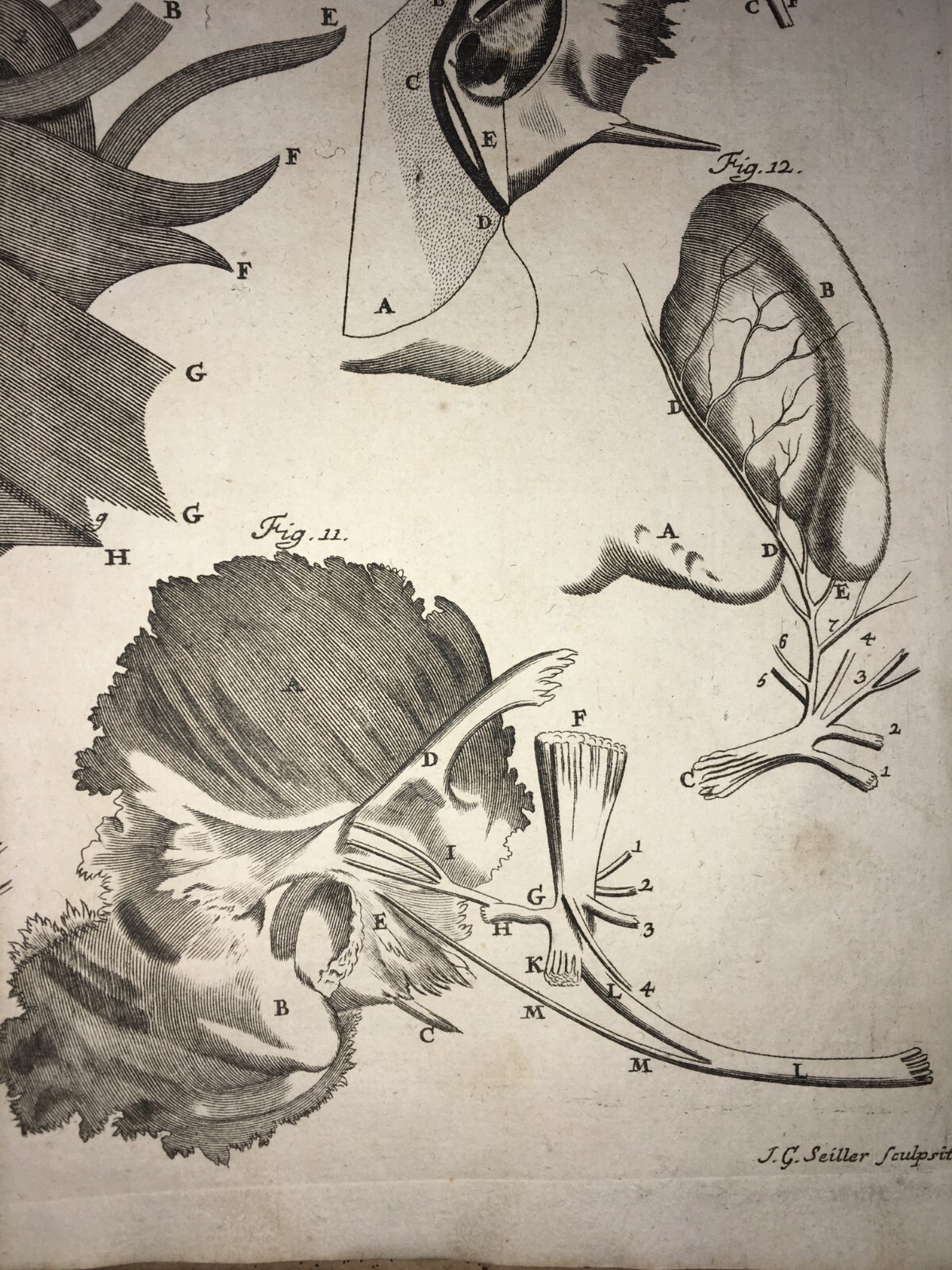 Medicina: Anatomia Umana, Organi Della Gola E Del Collo. Incisione Di Seiller, XVIII Secolo.