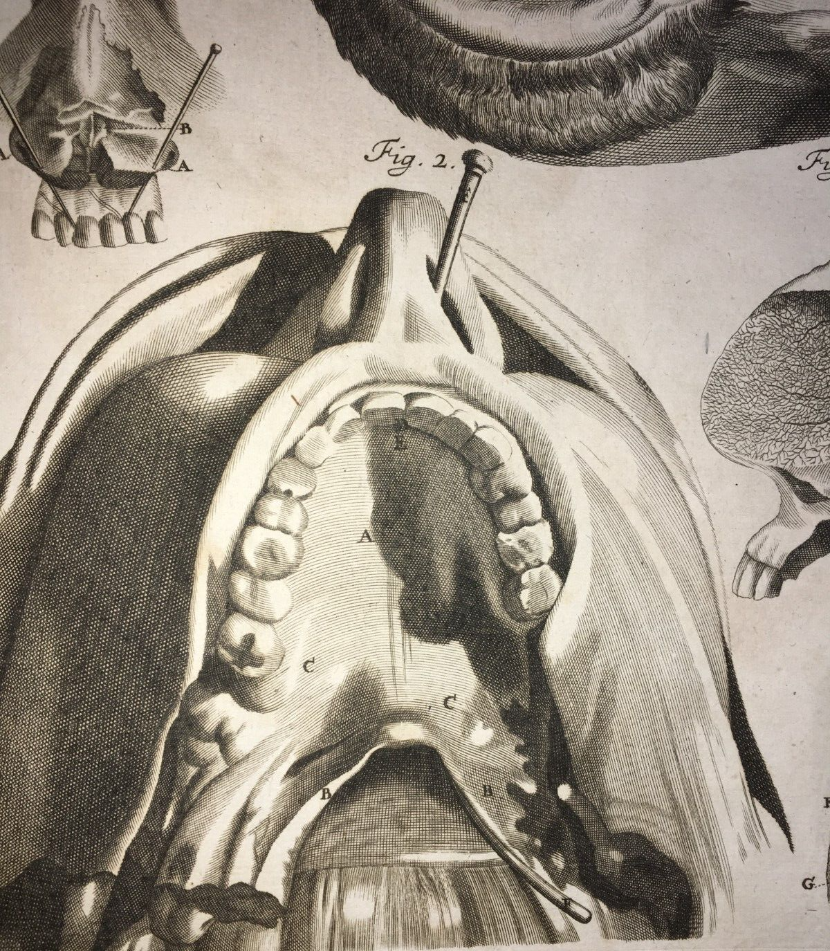 Anatomia Umana: Otorinolaringoiatria. Bocca, Gola, Denti E Orecchie (Seiller)