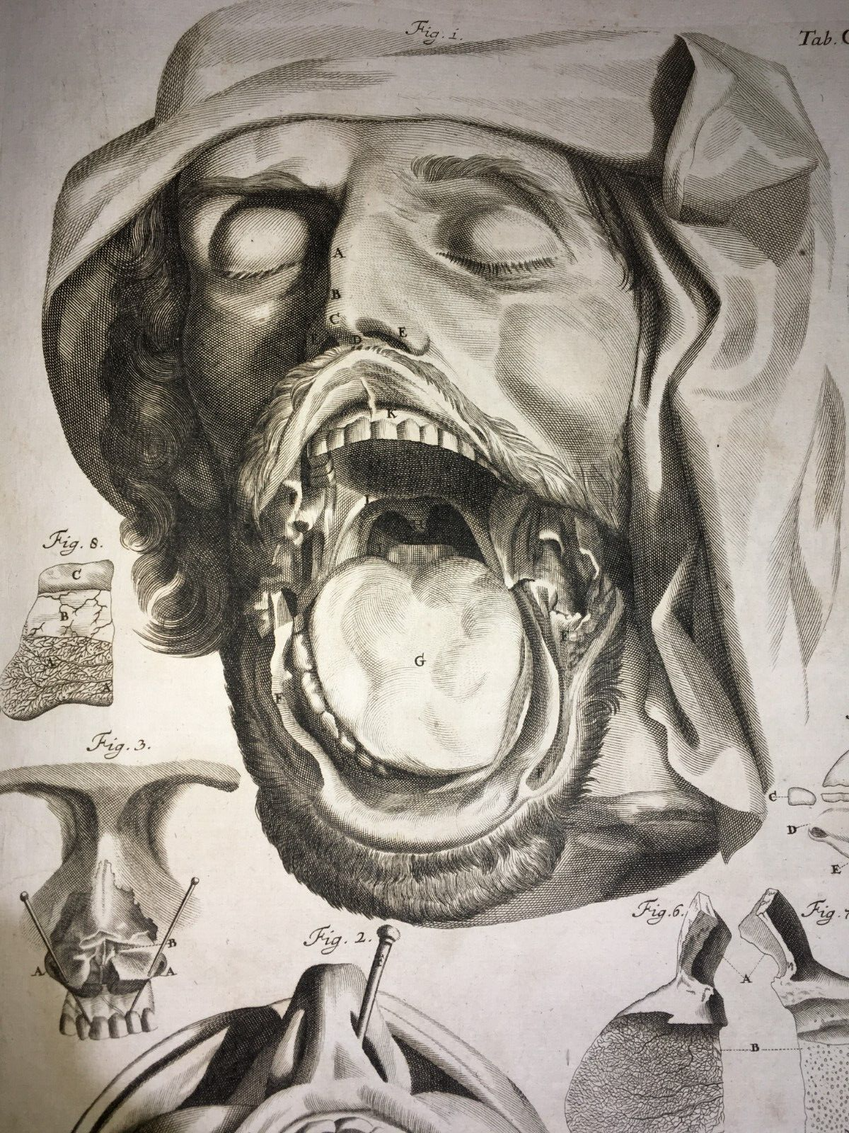 Anatomia Umana: Otorinolaringoiatria. Bocca, Gola, Denti E Orecchie (Seiller)