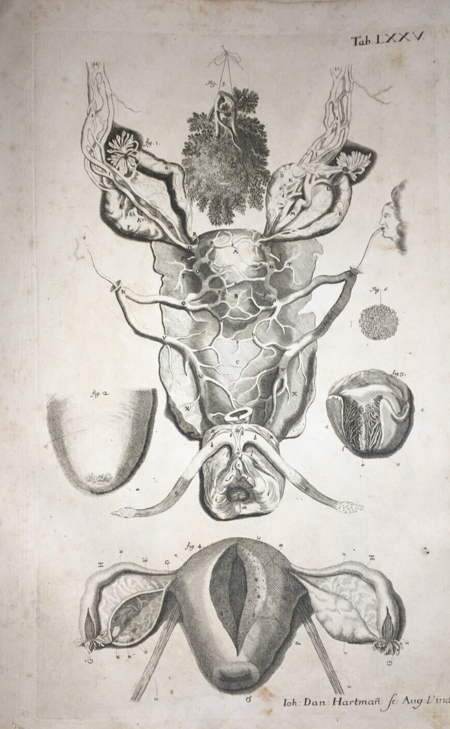 Medicina: Anatomia Umana E Ginecologia. Antica Incisione Di I.D. Hartman, XVIII Secolo.